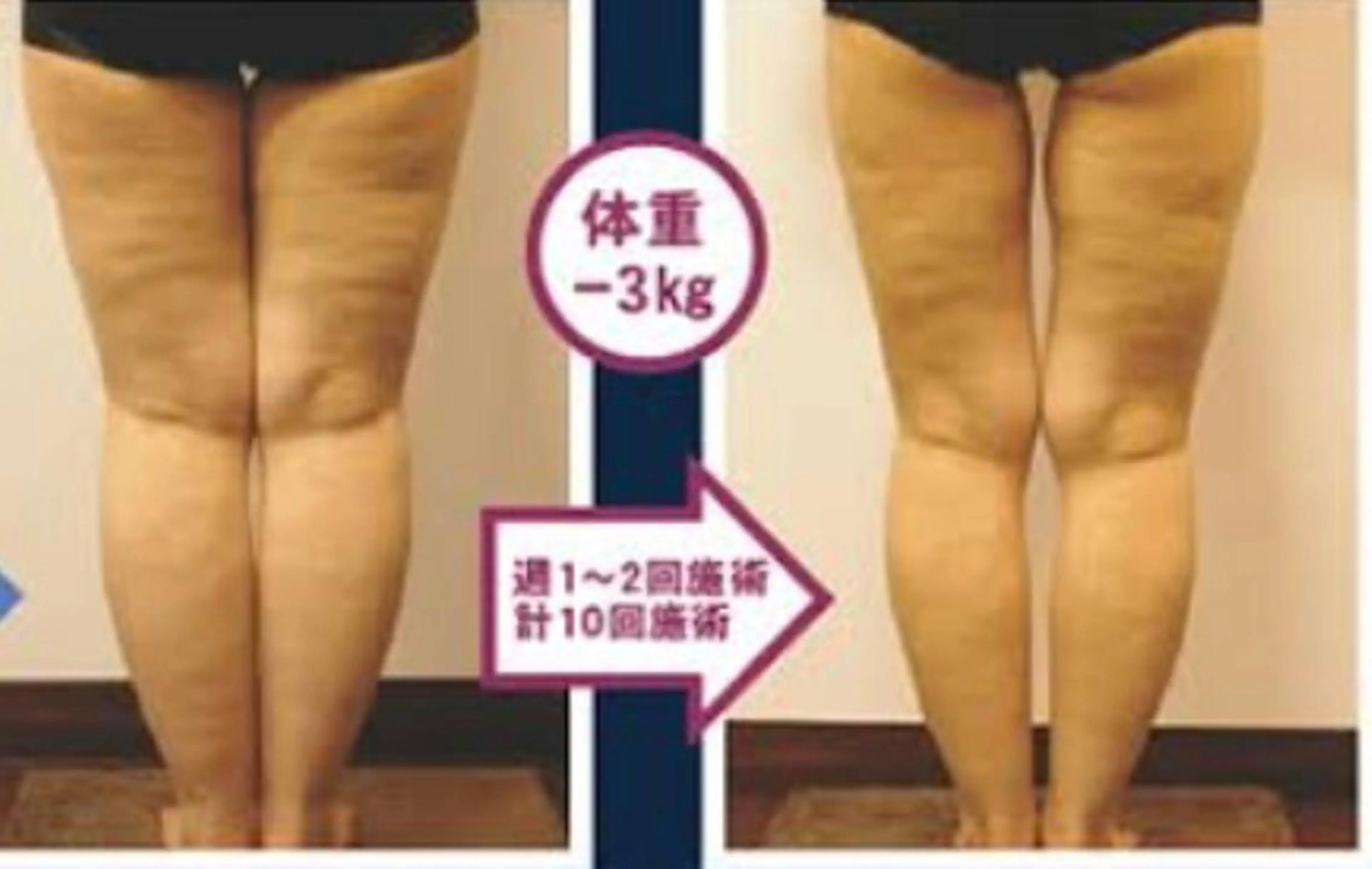 オイル＆フェイシャル 【月のあかり🌙】のエステ・リラクイメージ