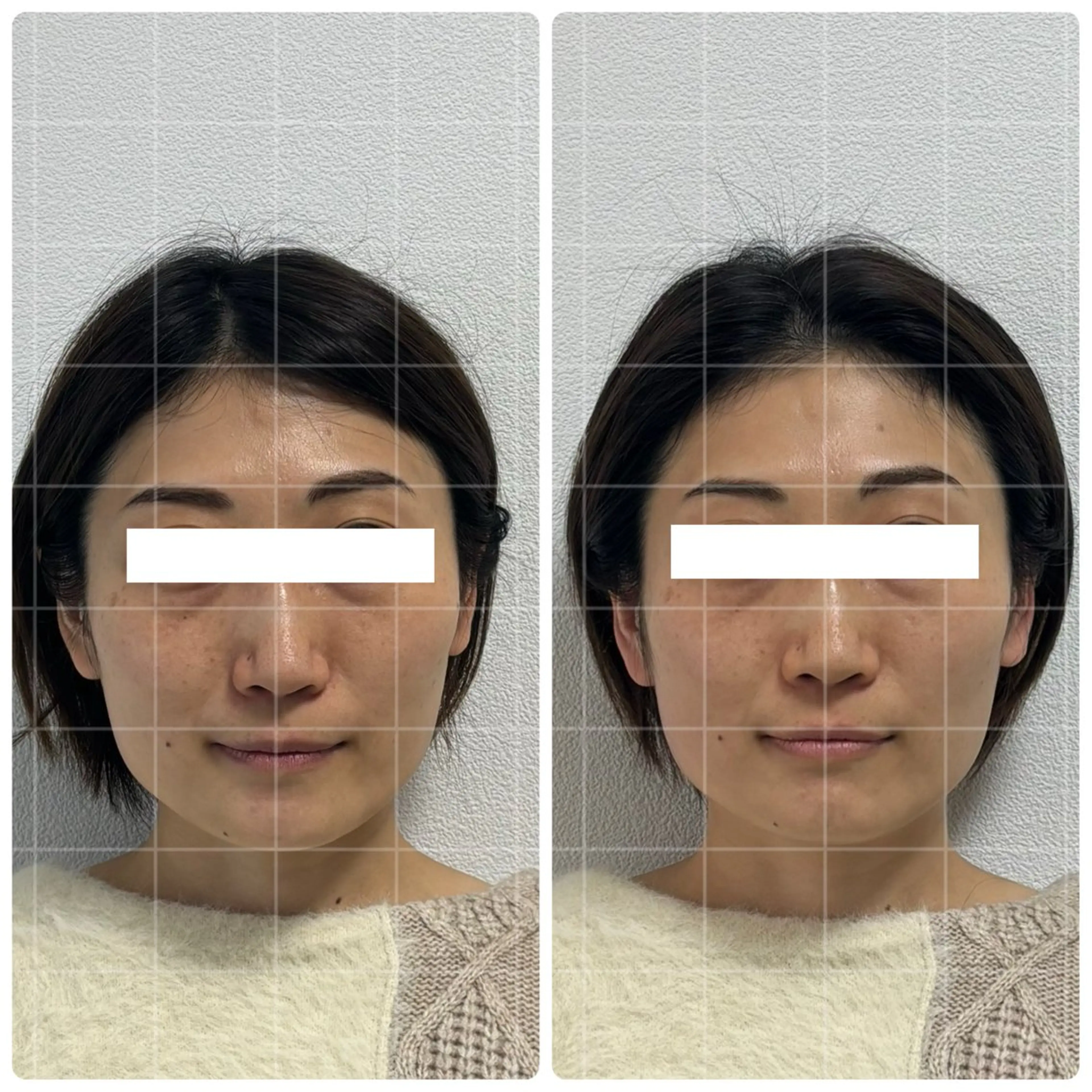 片山けいこ｜ 美人顔創りの専門家のエステ・リラクイメージ