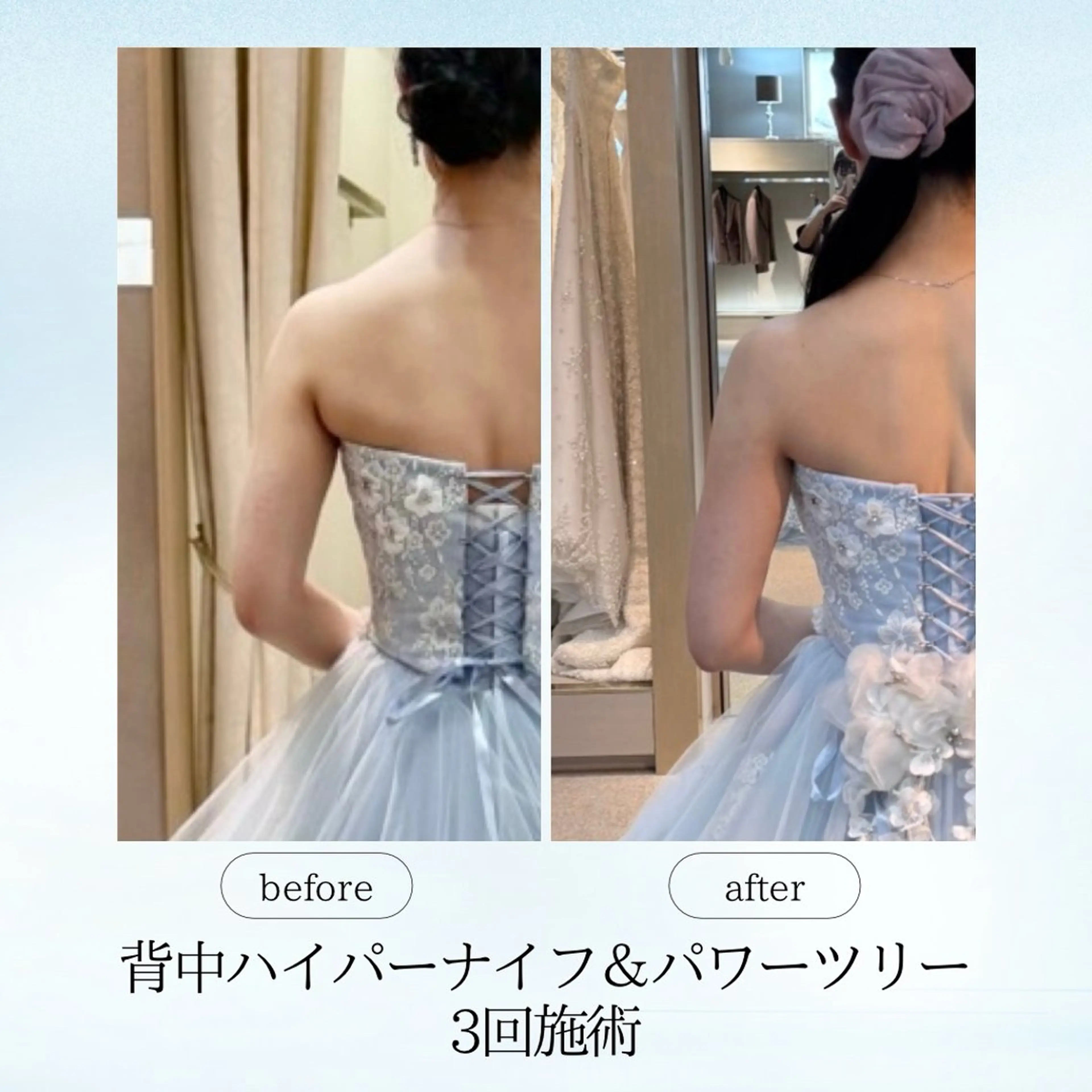 エステ リラク 《痩身、小顔専門店》 エスプレッソのエステ・リラクイメージ