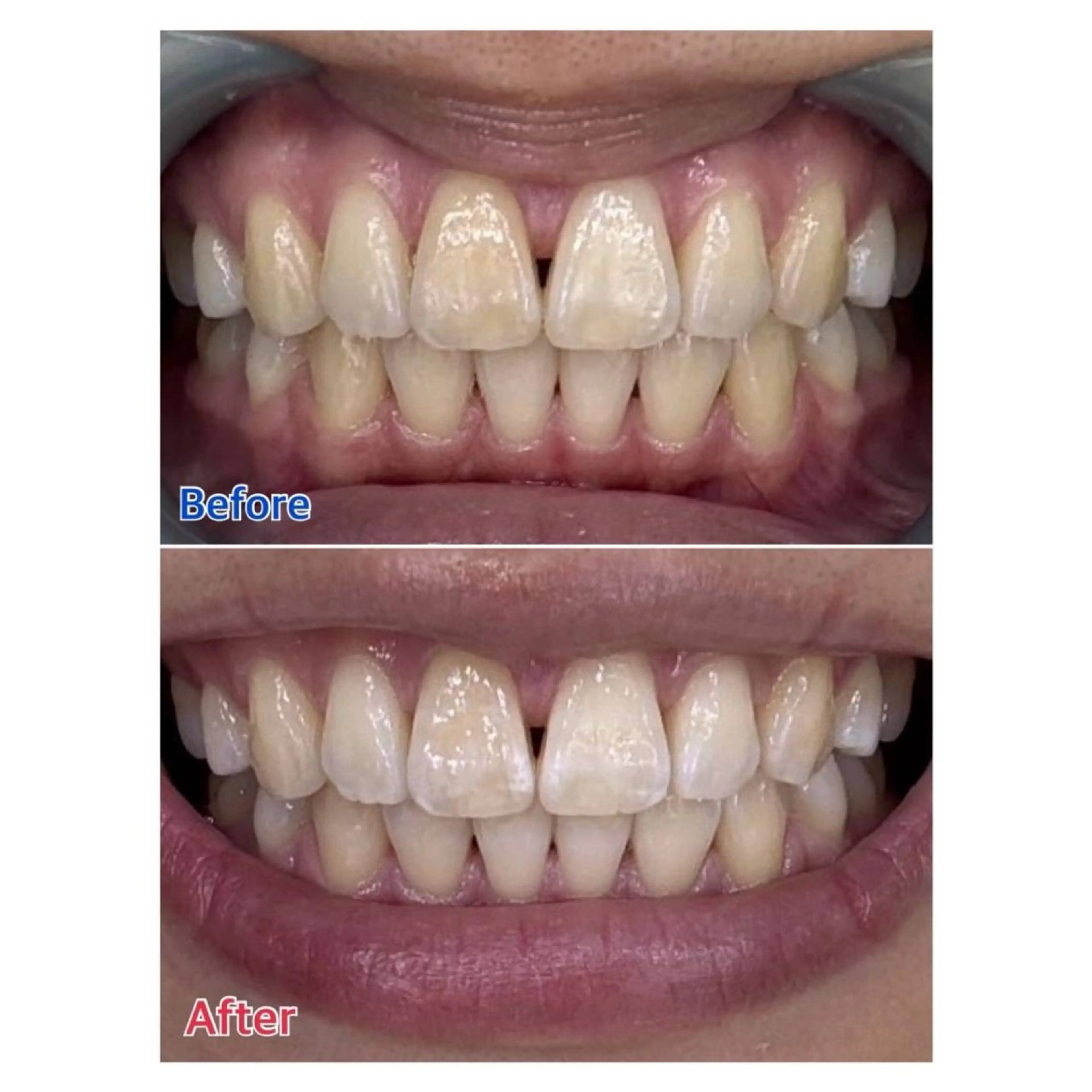 MBEAUTYSALON 千葉店・京成大久保所属・Melty 輝のその他イメージ