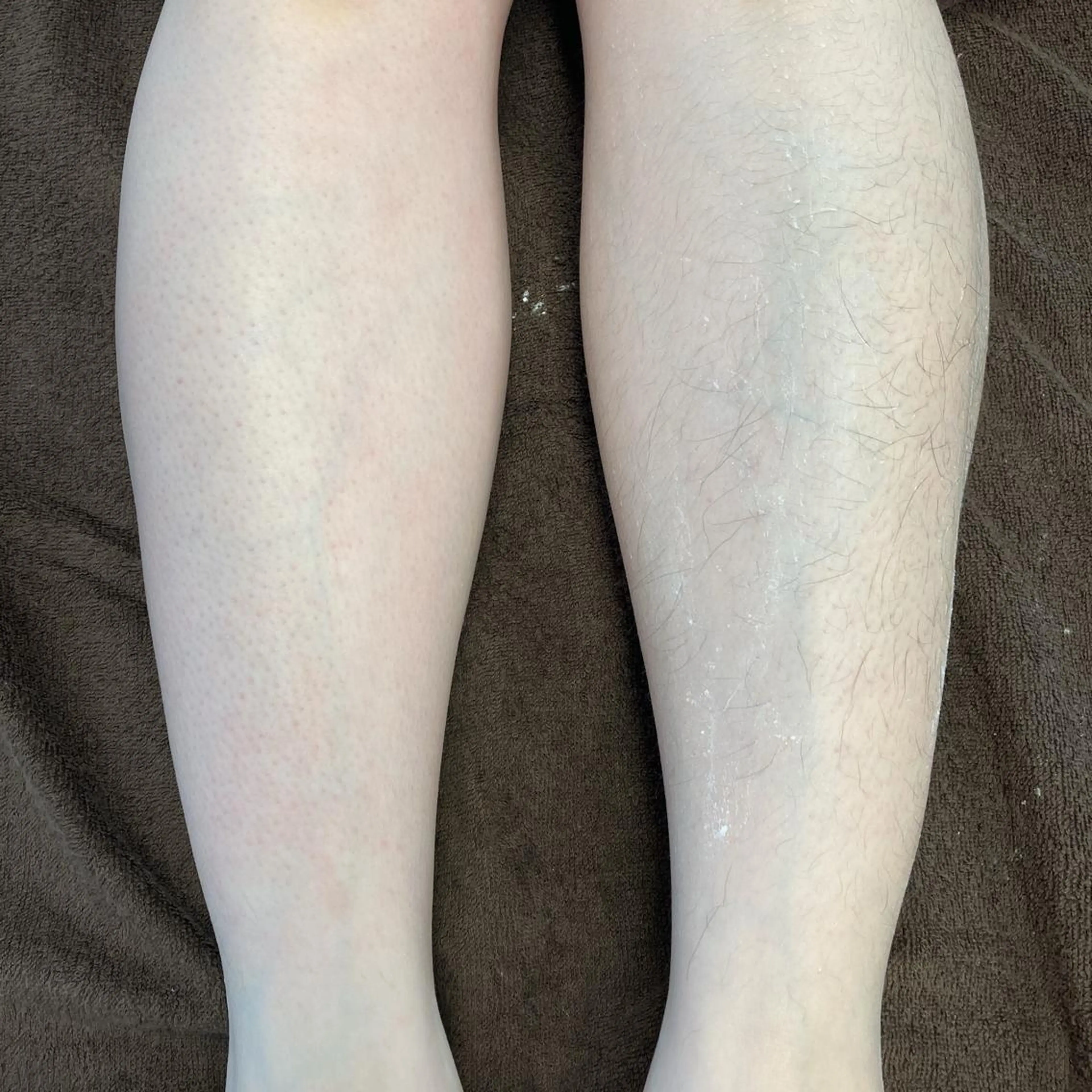 Dahliaダリア シュガーリングサロンのエステ・リラクイメージ