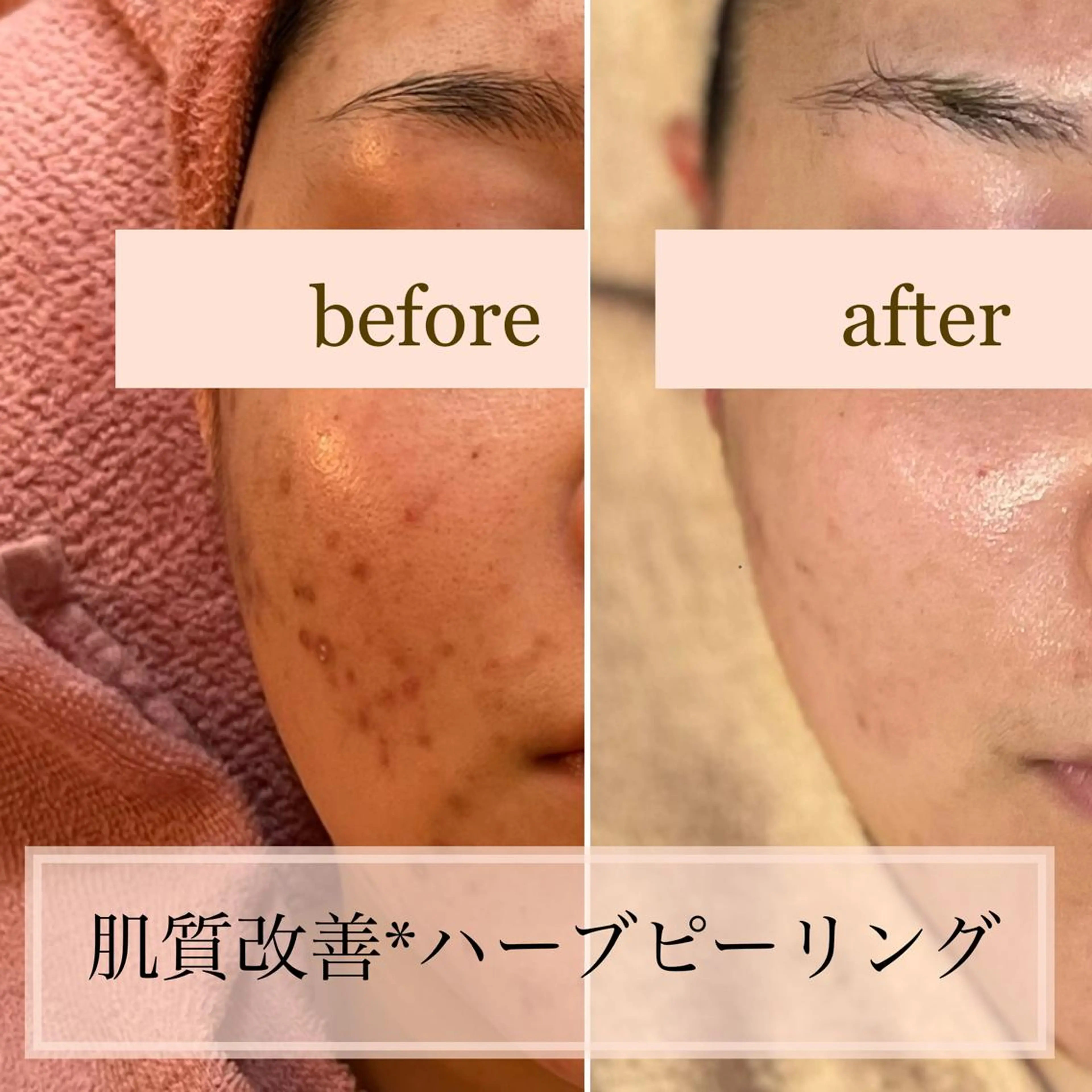 MKY salonのネイルデザイン