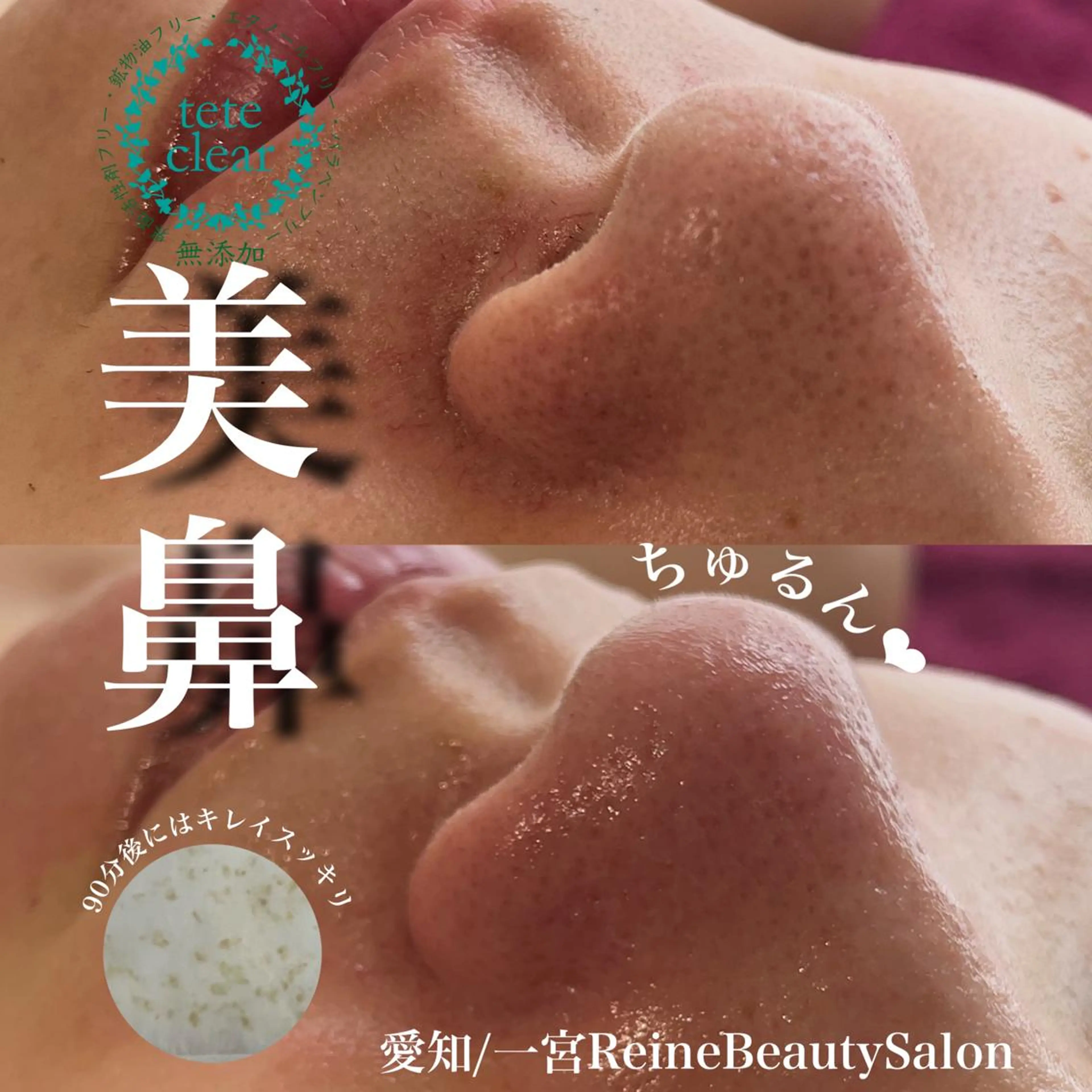 毛穴/シミ肝斑/脱毛 横山梨里のエステ・リラクイメージ