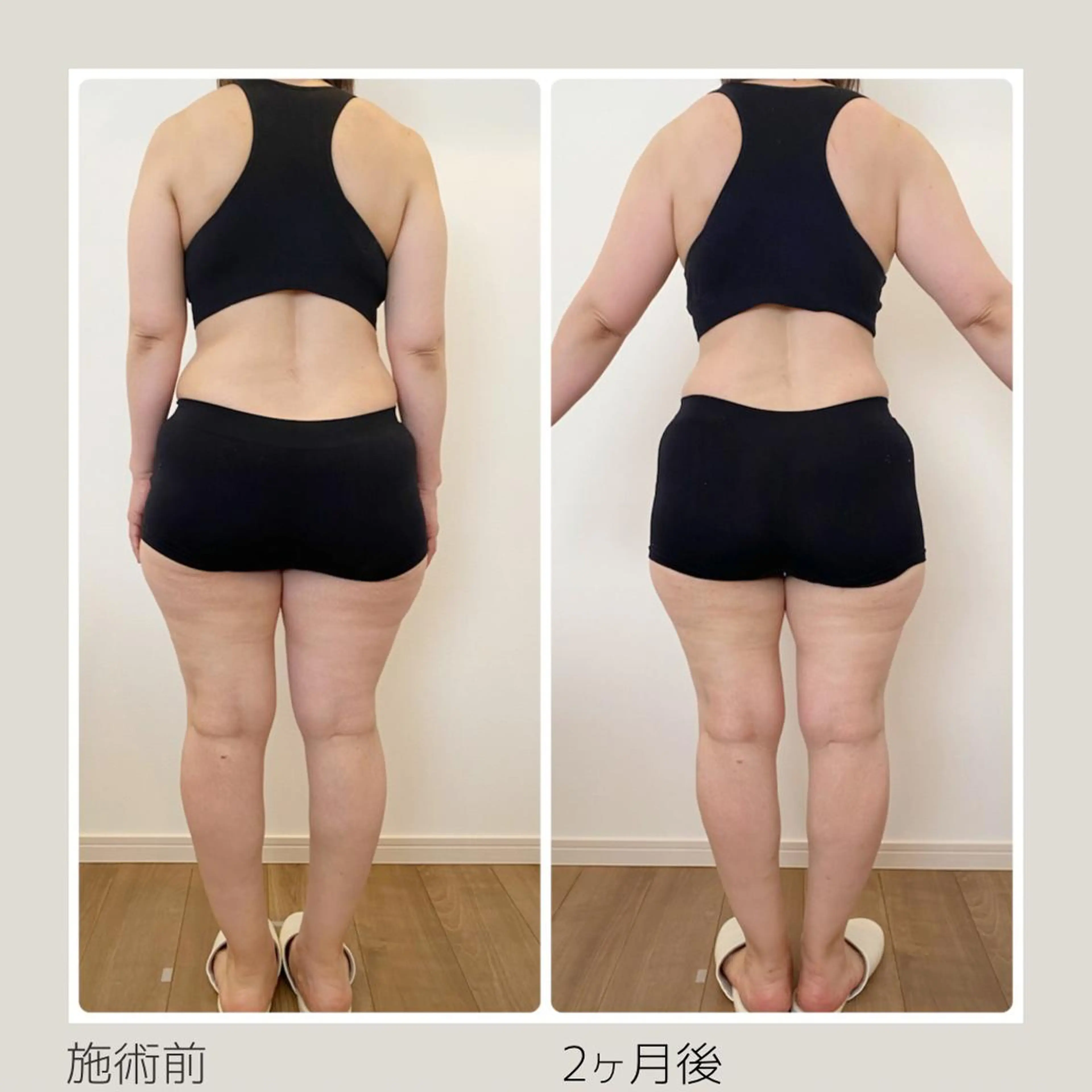 痩身＆ヘッド 長倉絵美のエステ・リラクイメージ