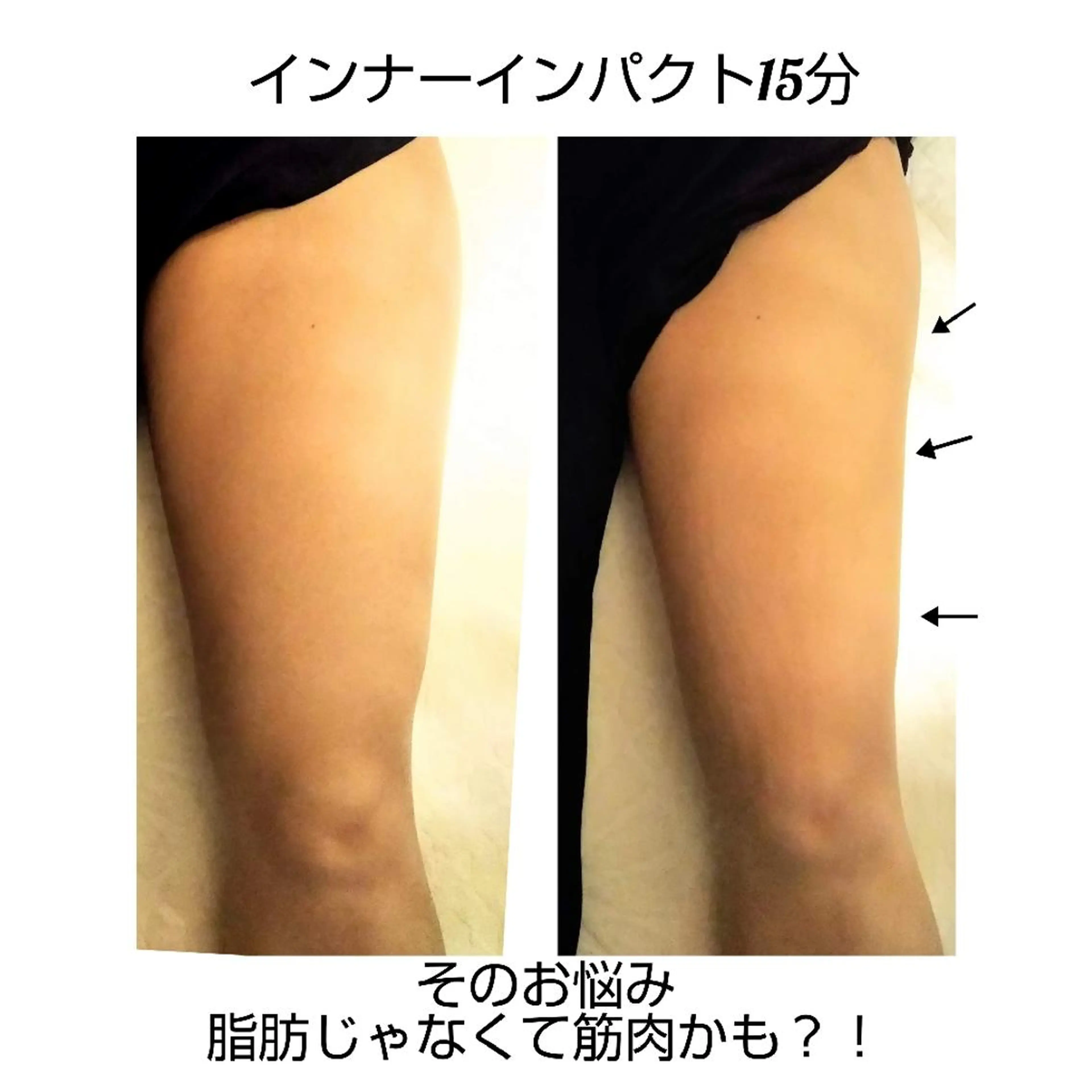 【ニキビ/肌管理】 salon varyのエステ・リラクイメージ