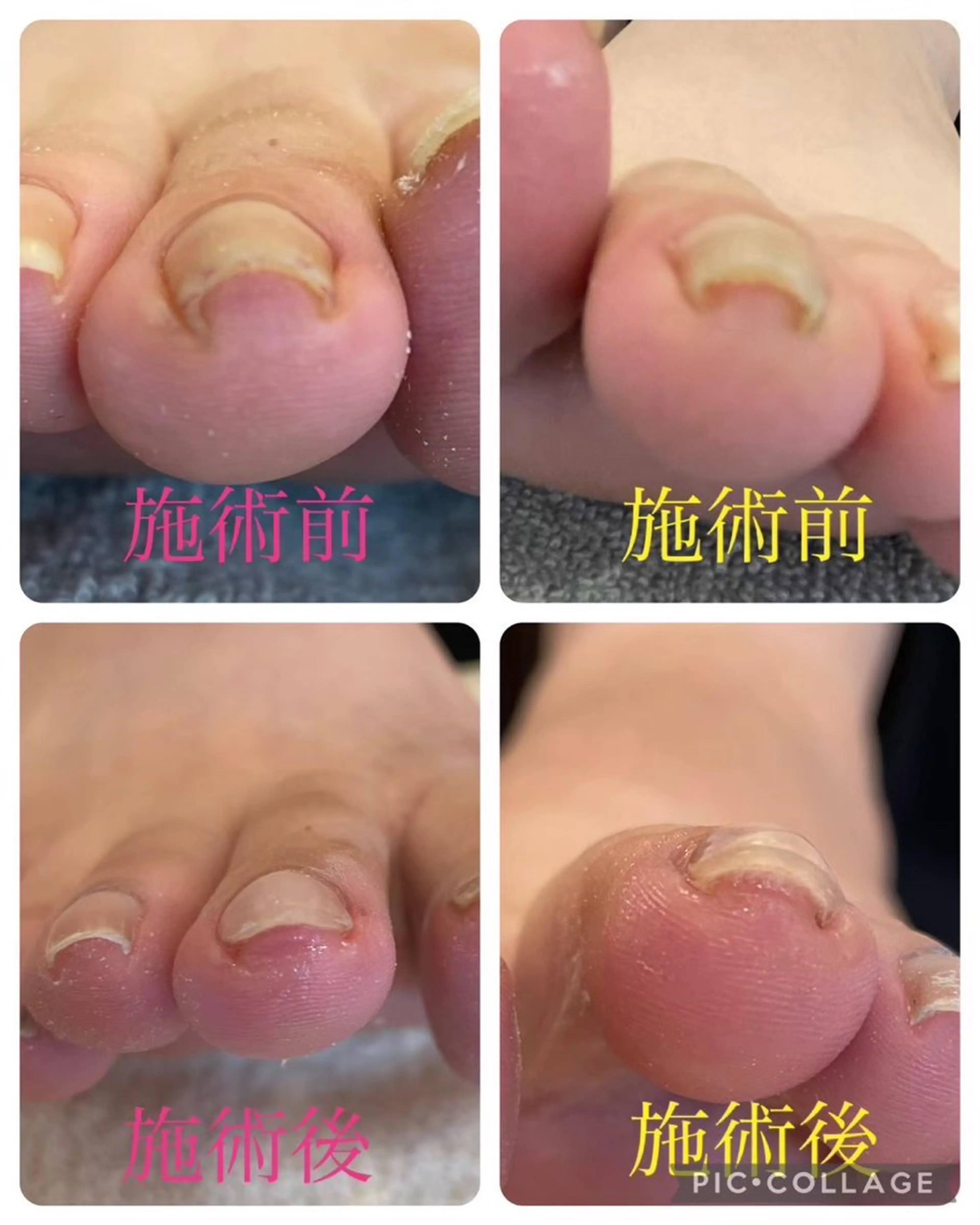 足のトラブル巻き爪補正専門店るみえーる所属・EYELASH SARONるみえーるのマツエク・マツパデザイン