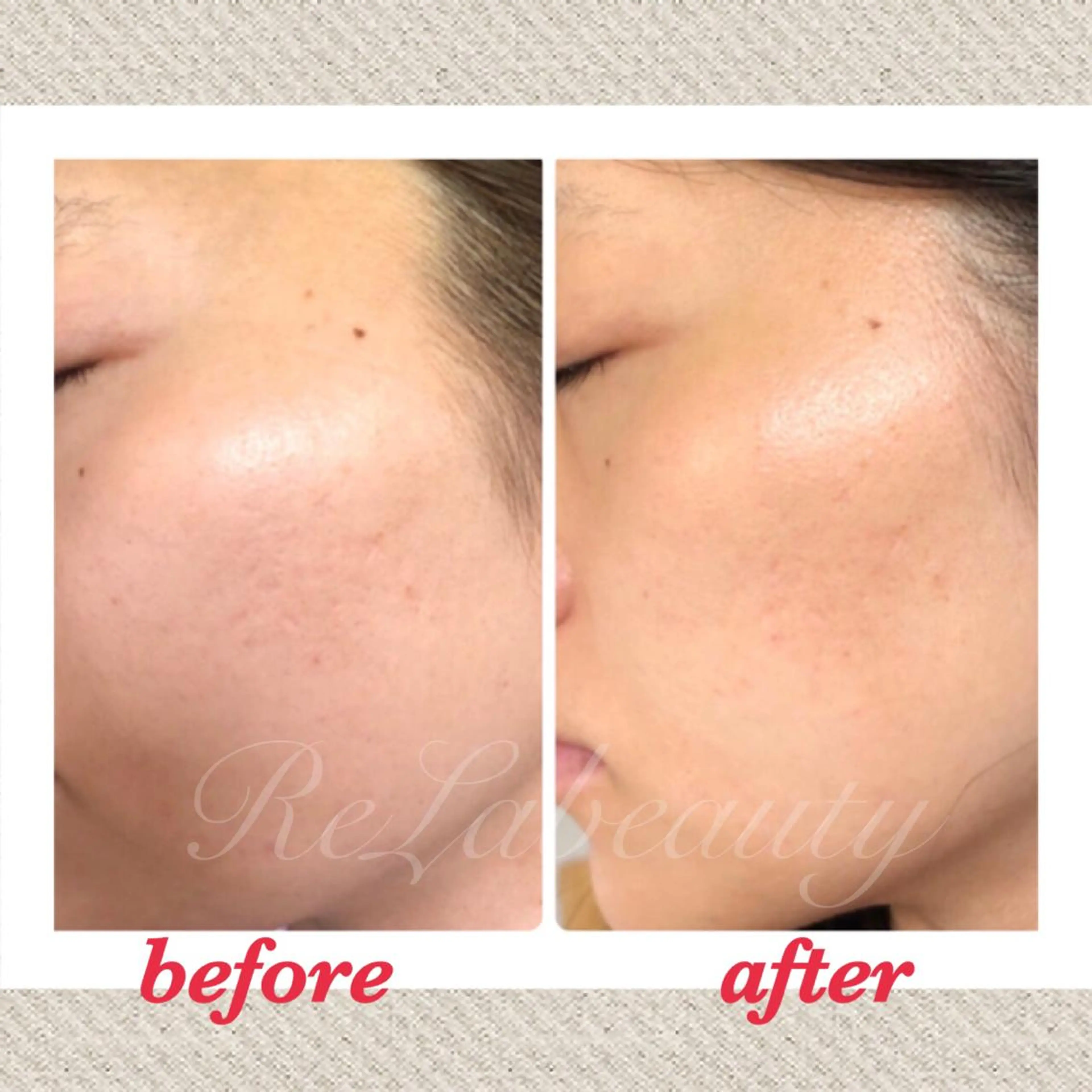 美ola ビオラのエステ・リラクイメージ