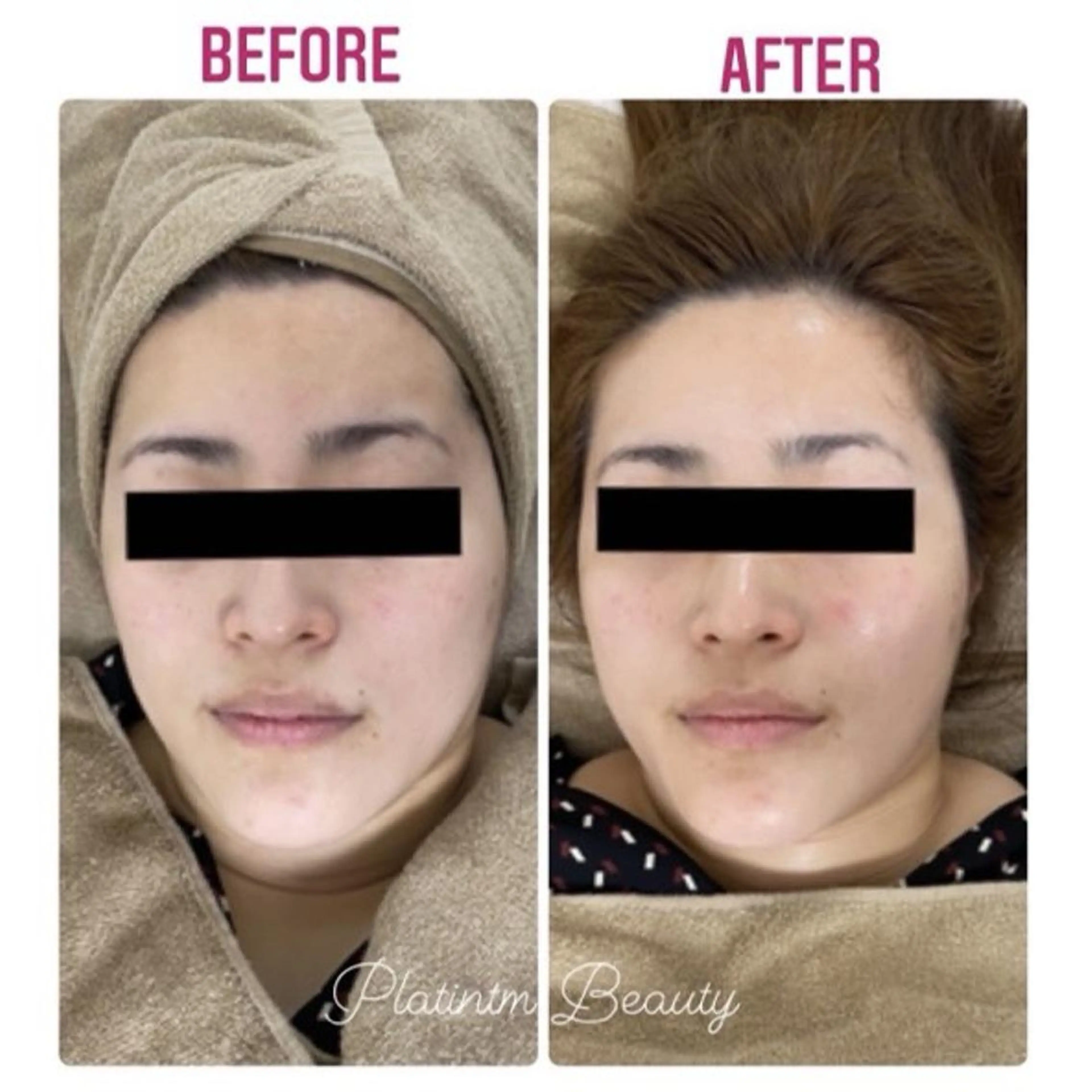 プラティーヌ ボーテのその他イメージ