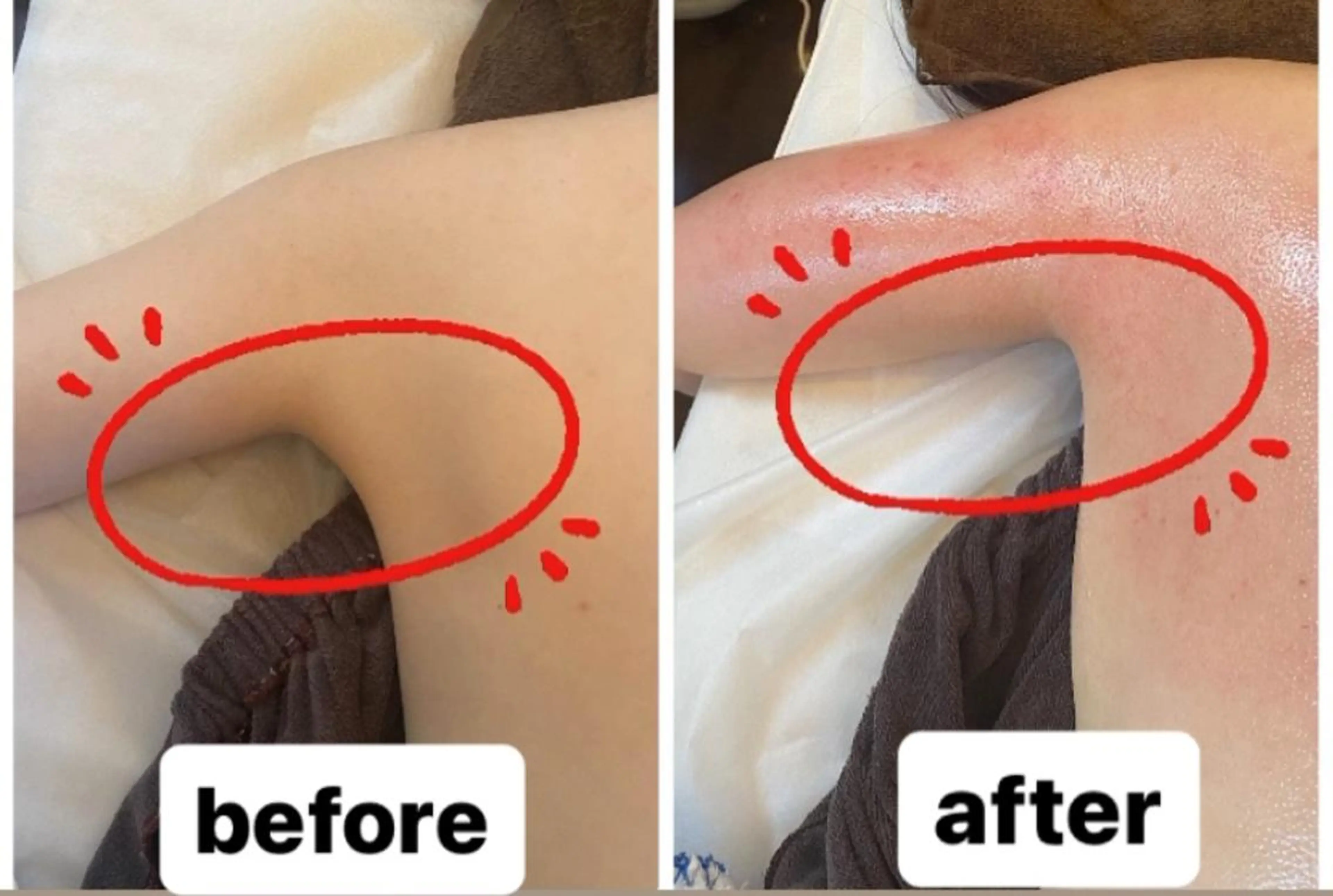 エステ リラク 脱毛・エステサロン LuLuNのエステ・リラクイメージ