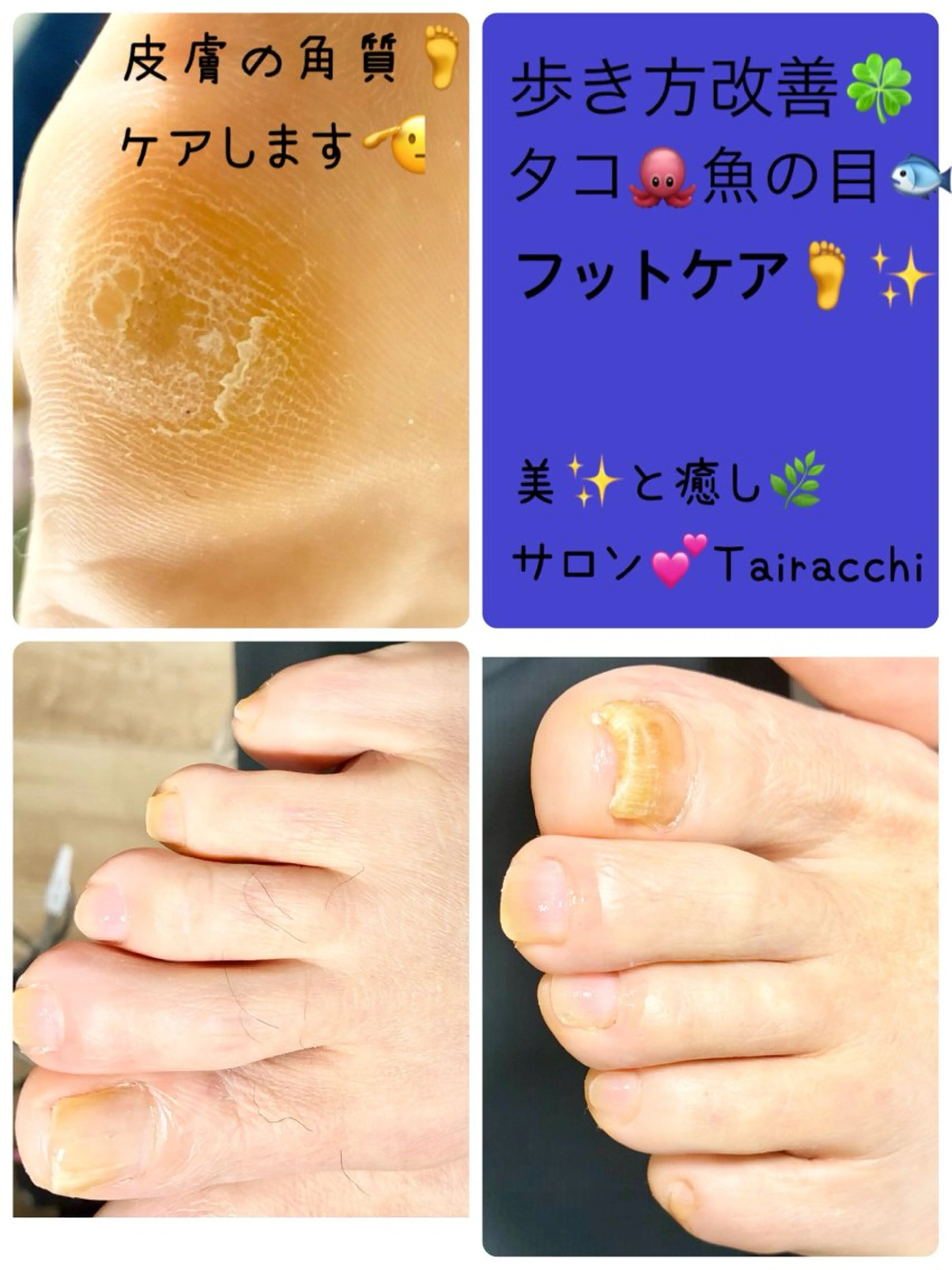 ネイル フットネイル フットネイル Tairacchi タイラッチのネイルデザイン