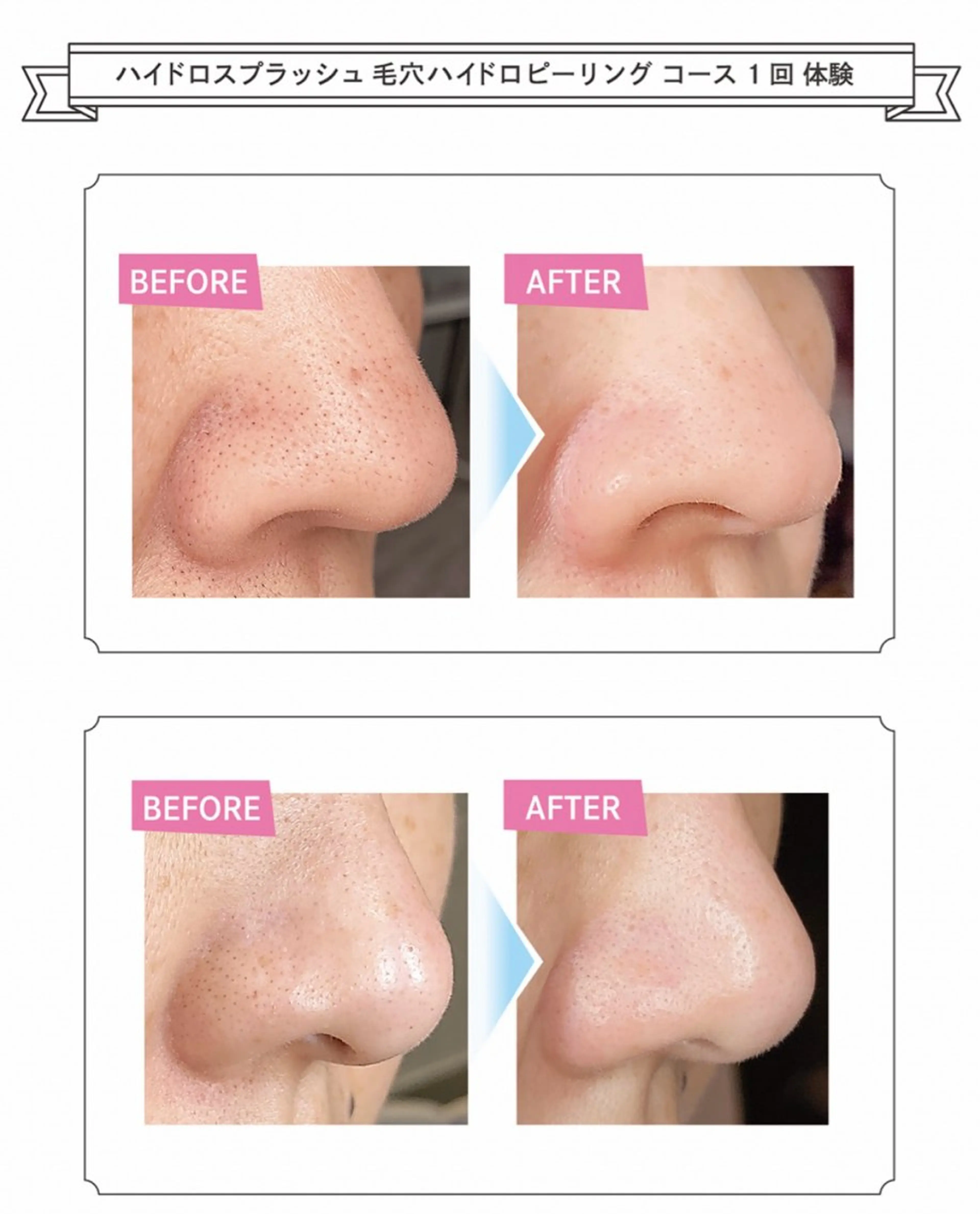 駒月 明日香の眉毛・アイブロウイメージ