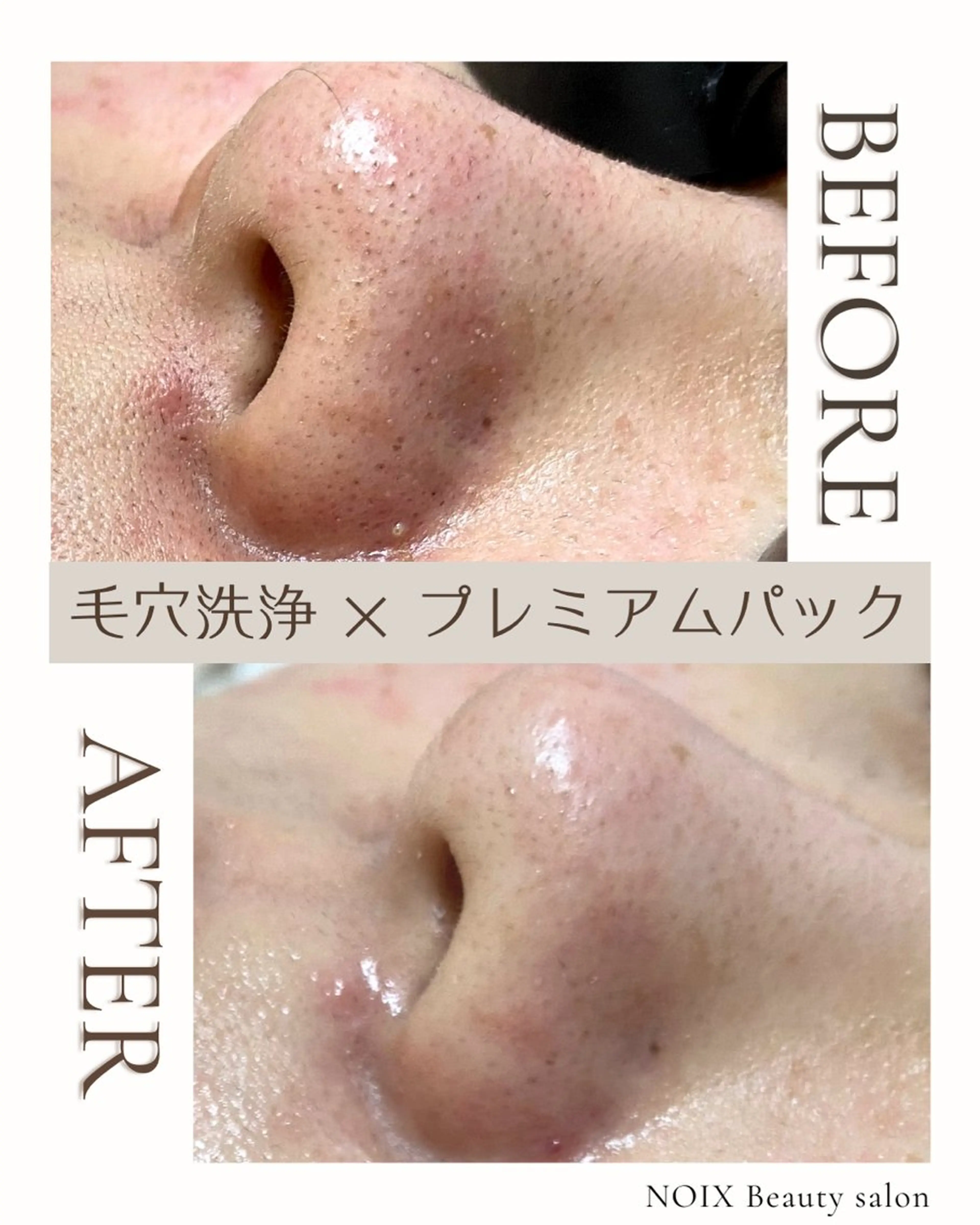 NOIXbeauty salonのエステ・リラクイメージ