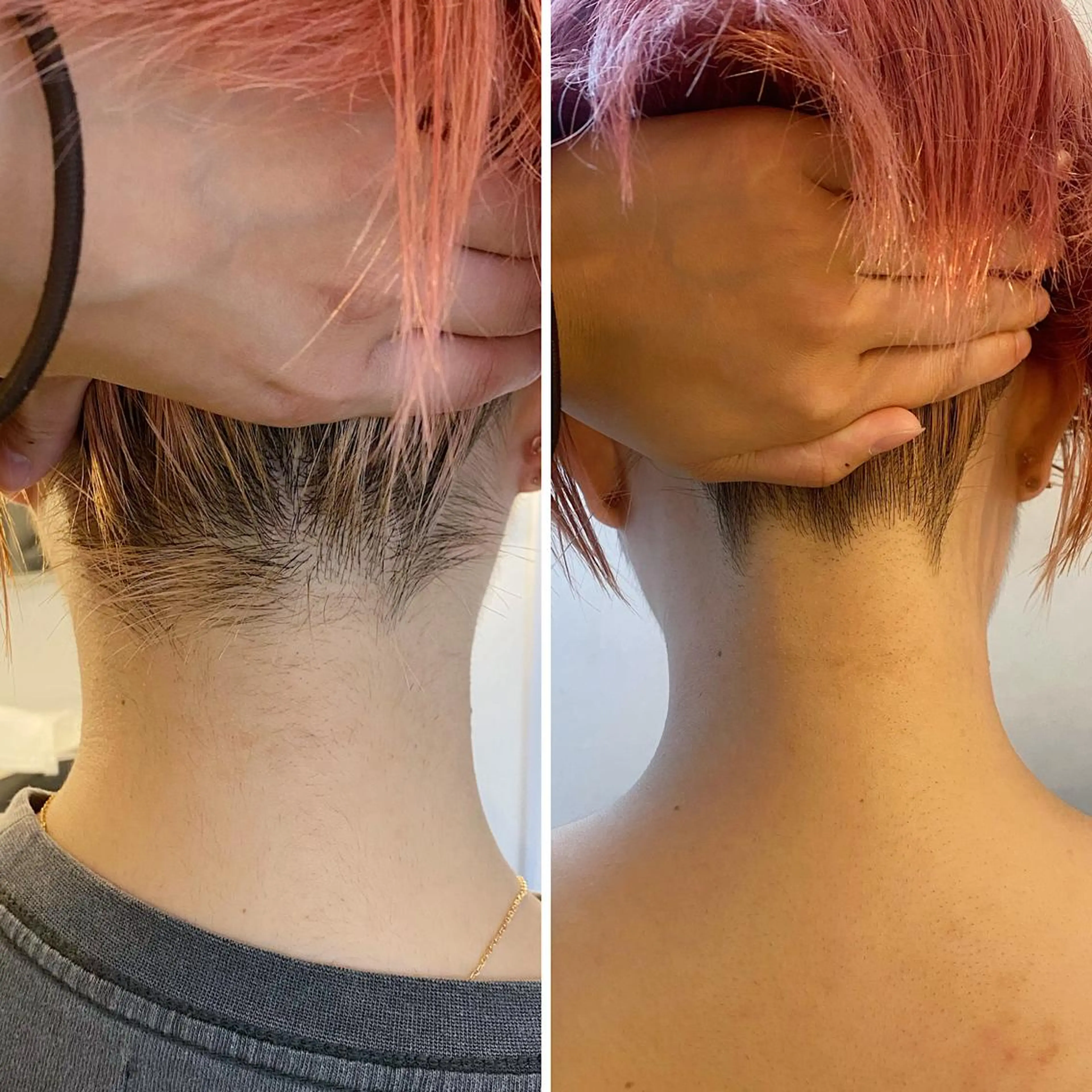 脱毛 うなじ脱毛/美肌脱毛 LABELのエステ・リラクイメージ