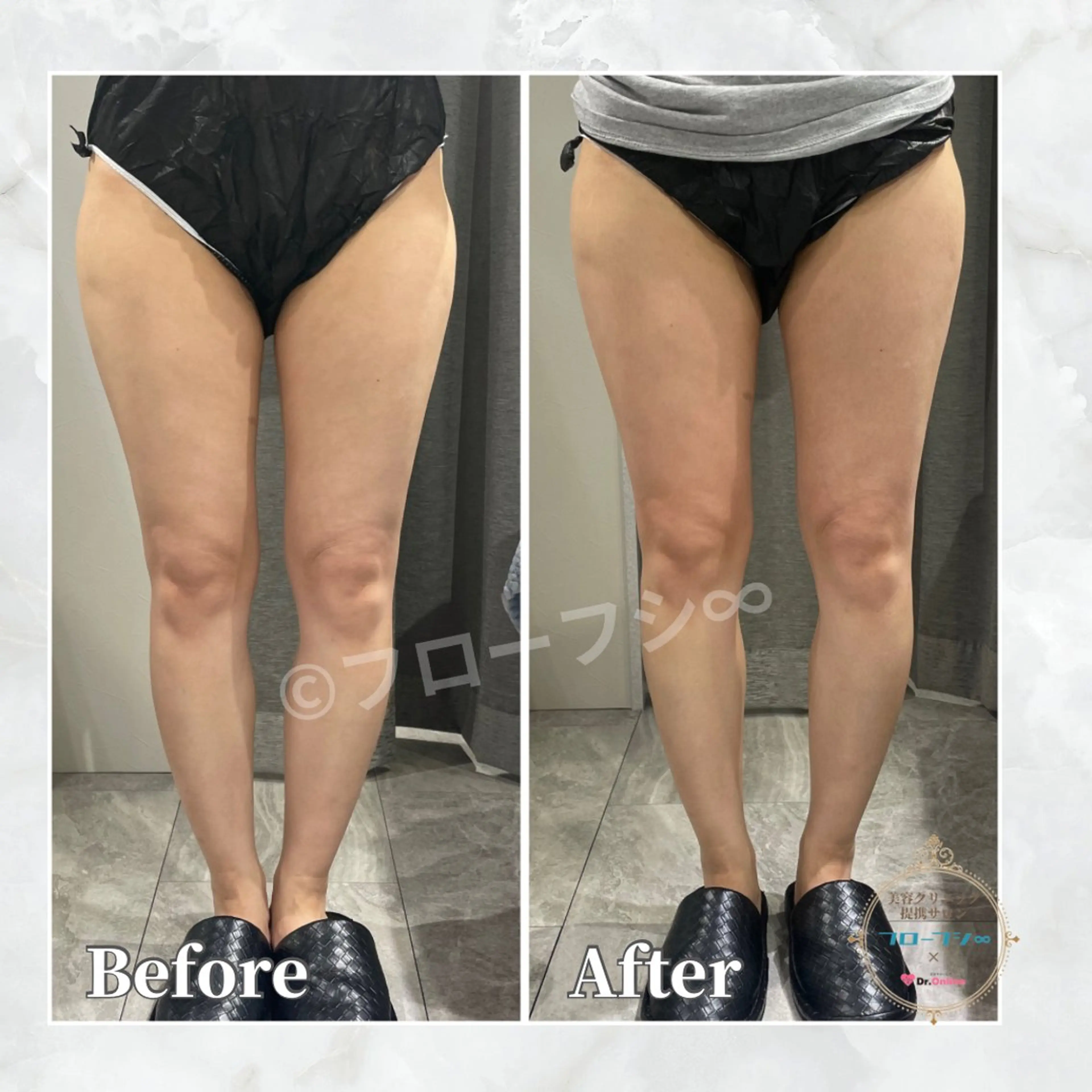 エステ 💎痩身&小顔 NATSUMI💎のエステ・リラクイメージ