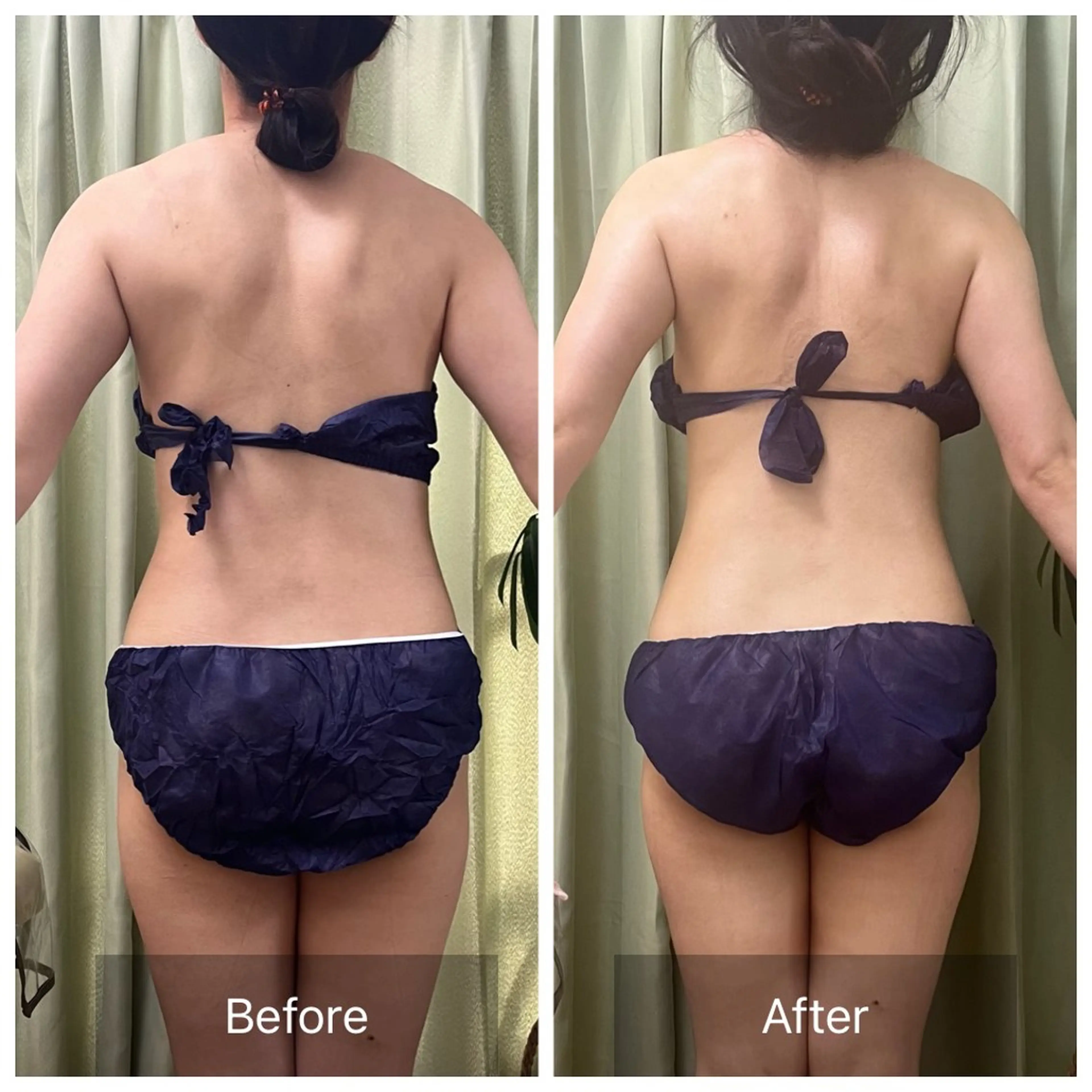 【元に戻らない】 小顔&部分痩せのその他イメージ