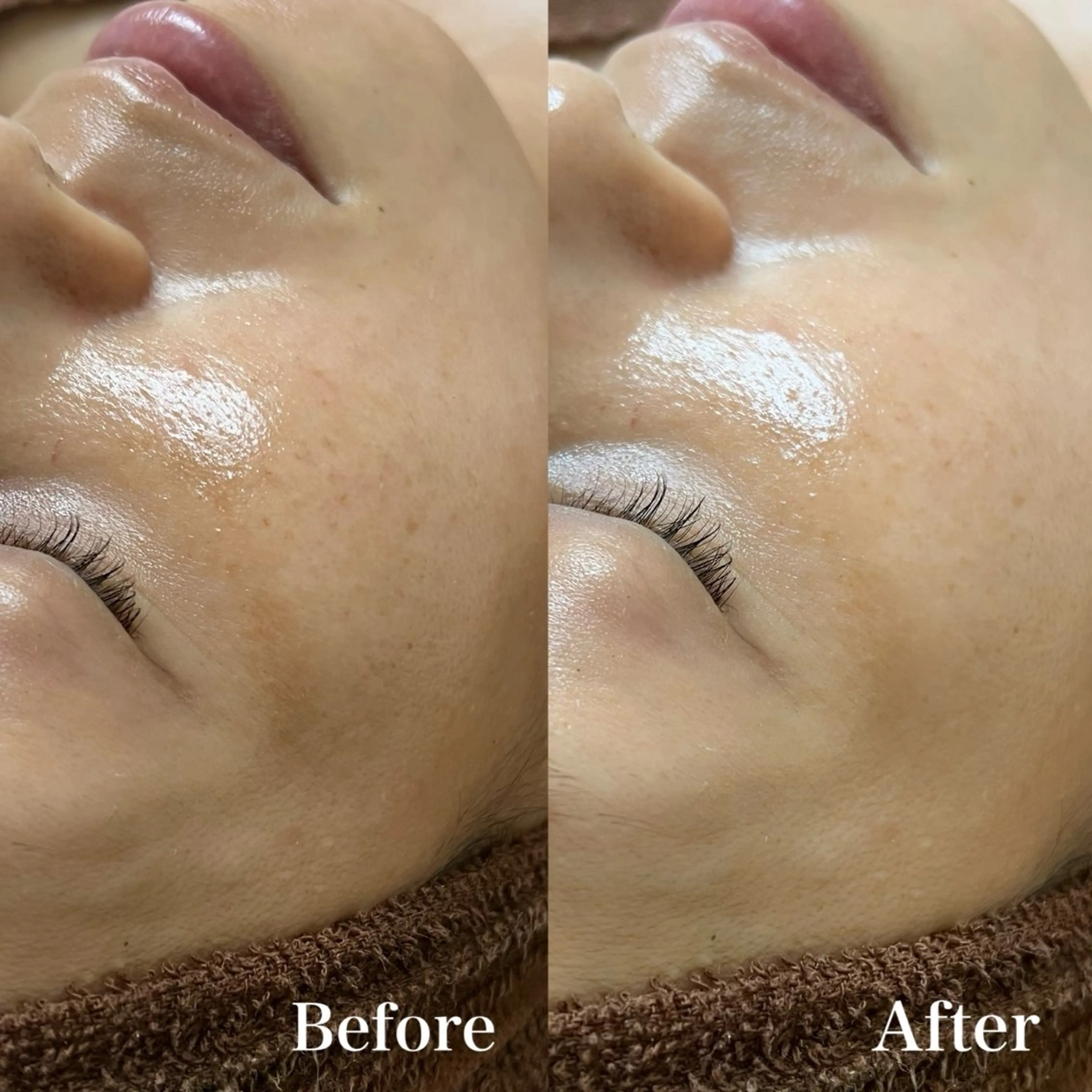 エステ 𝐌𝐚𝐜𝐡𝐞 𝐛𝐲 𝐌𝐚𝐲𝐮所属・ハーブピーリング🌿 𝑴𝒂𝒚𝒖のエステ・リラクイメージ