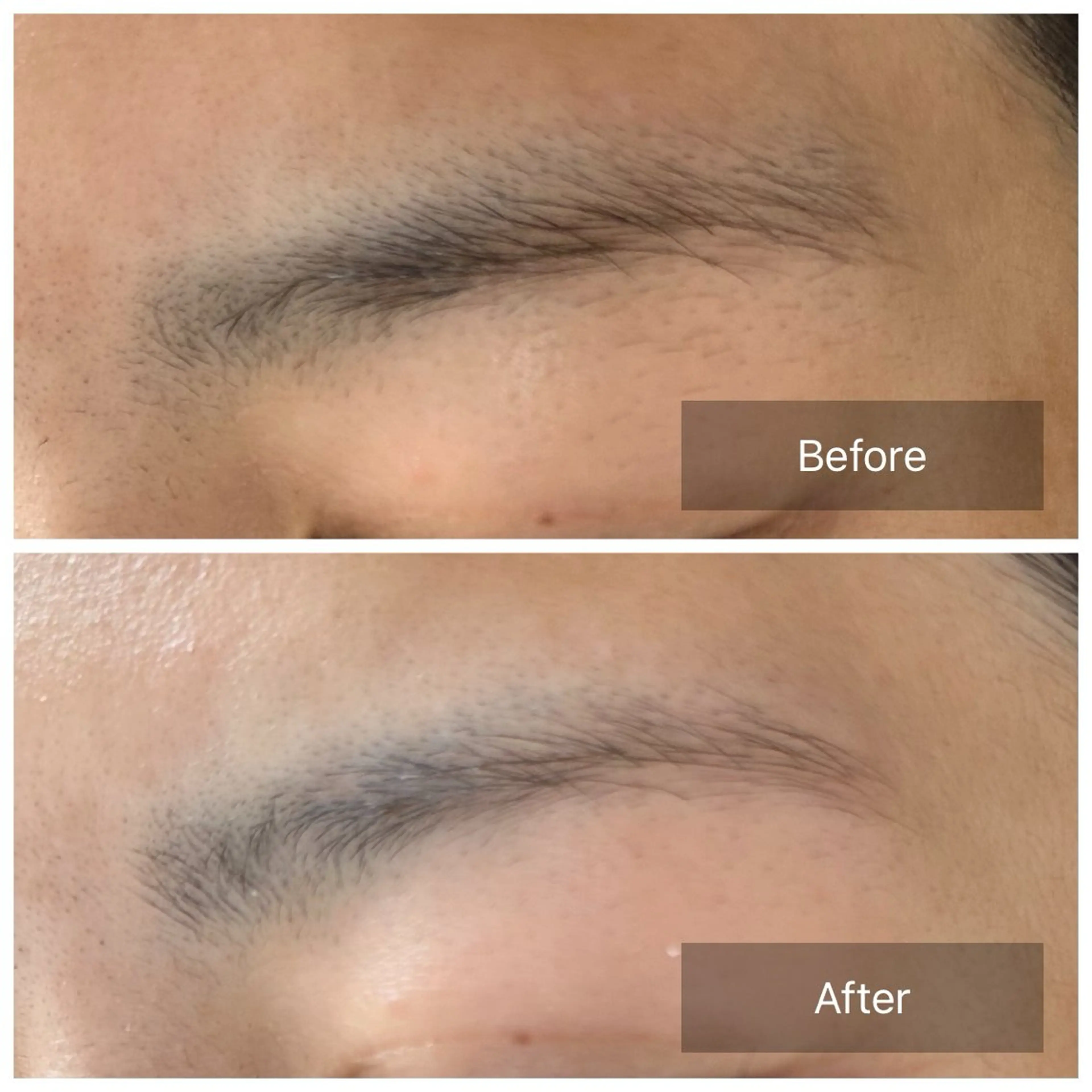 アイブロウ ワックス脱毛 眉カット その他(アイブロウ) トータルしみケア専門 NICA(ニカ)の眉毛・アイブロウイメージ