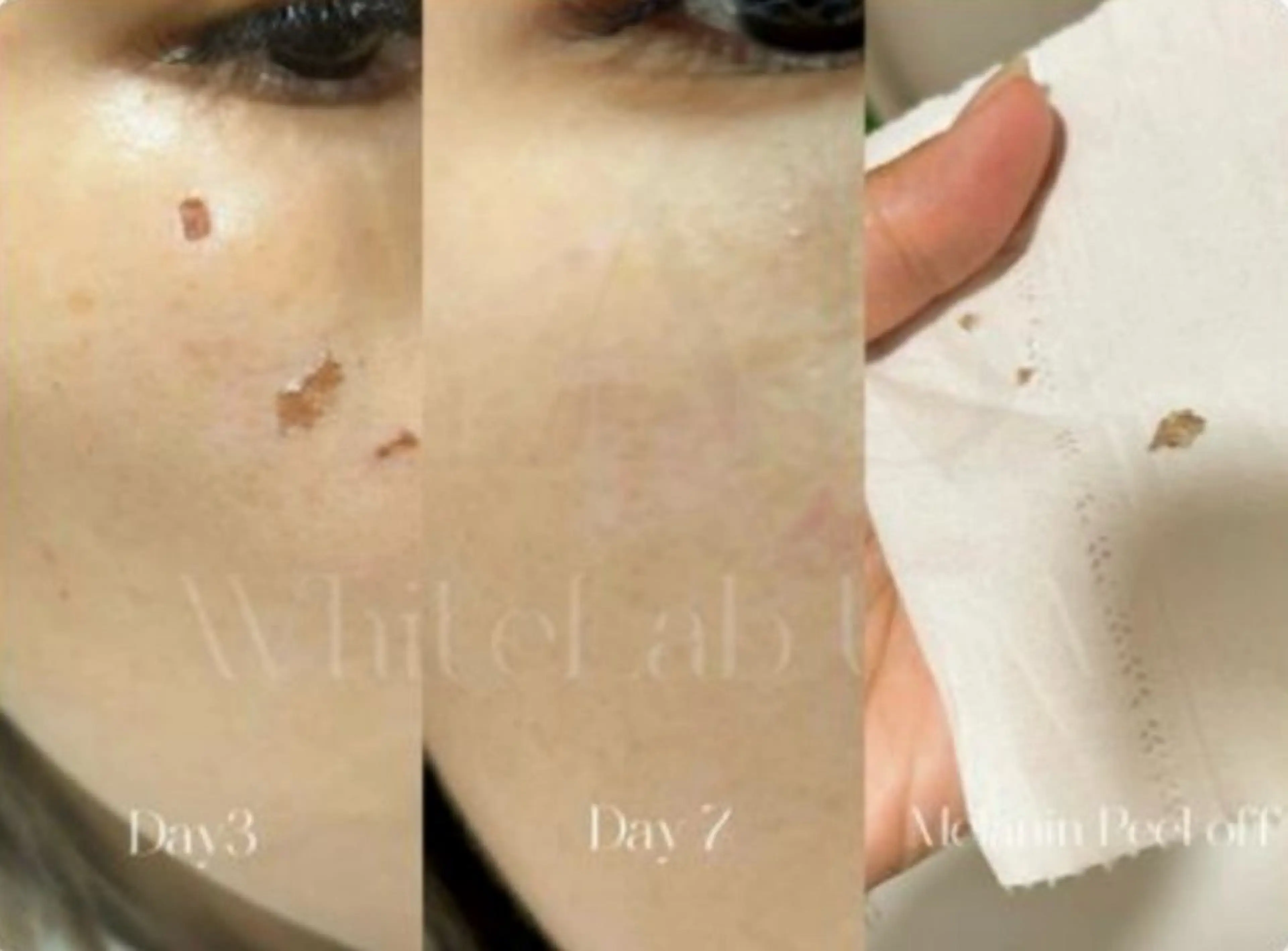 Ｍ渋谷 ホワイトニングのエステ・リラクイメージ