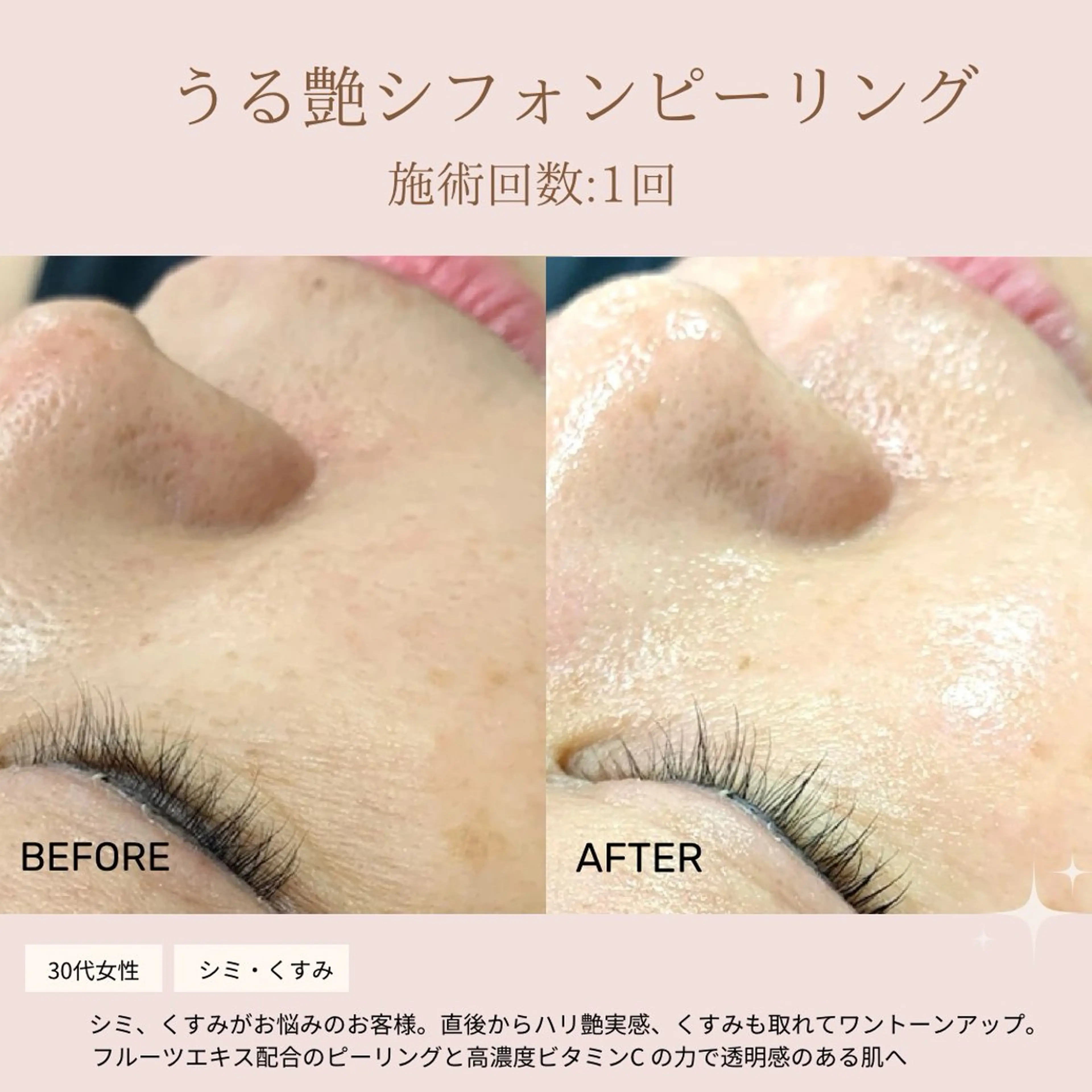 肌質改善専門サロン Bellmi/心斎橋のエステ・リラクイメージ