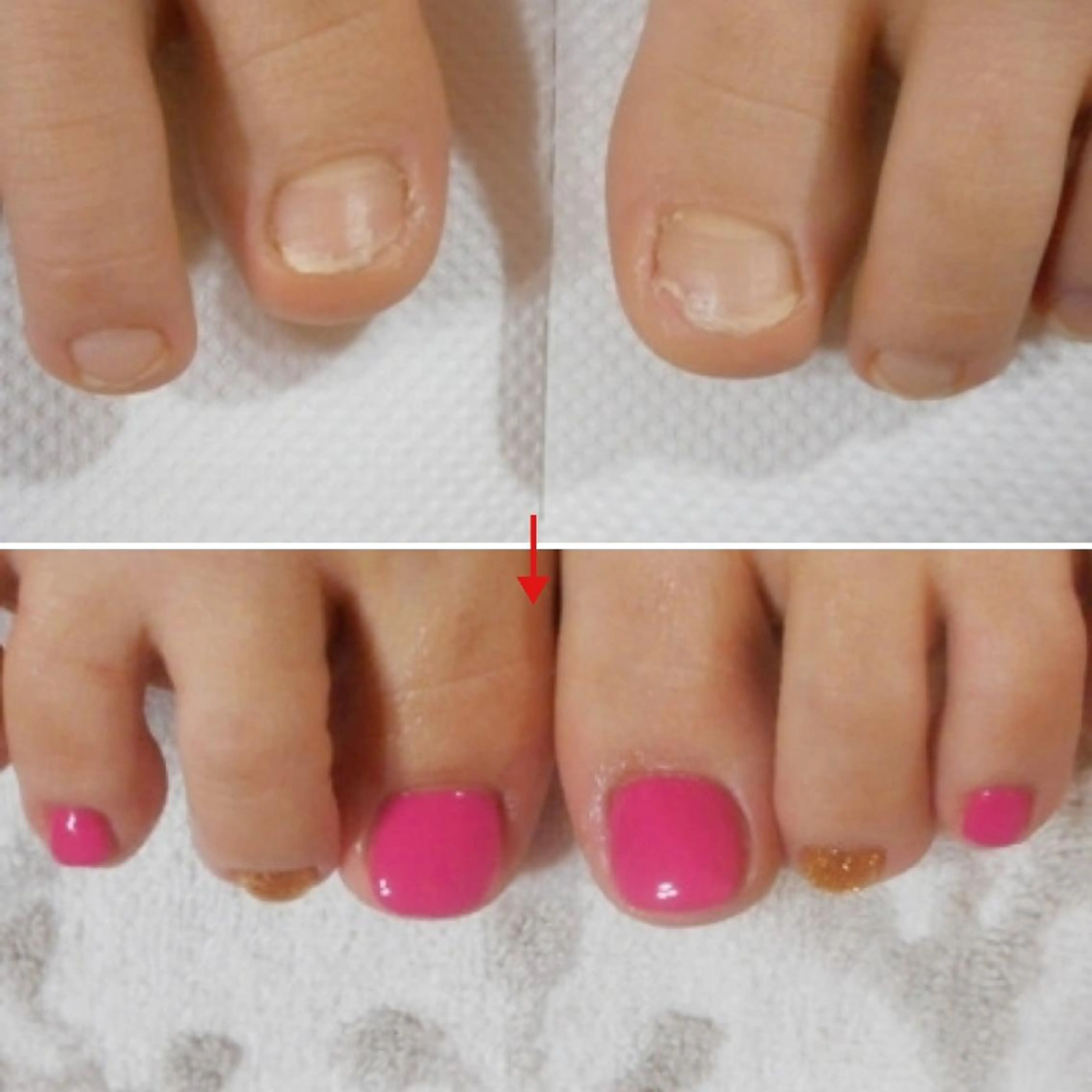 ネイル ネイルサロン アリュームのネイルデザイン