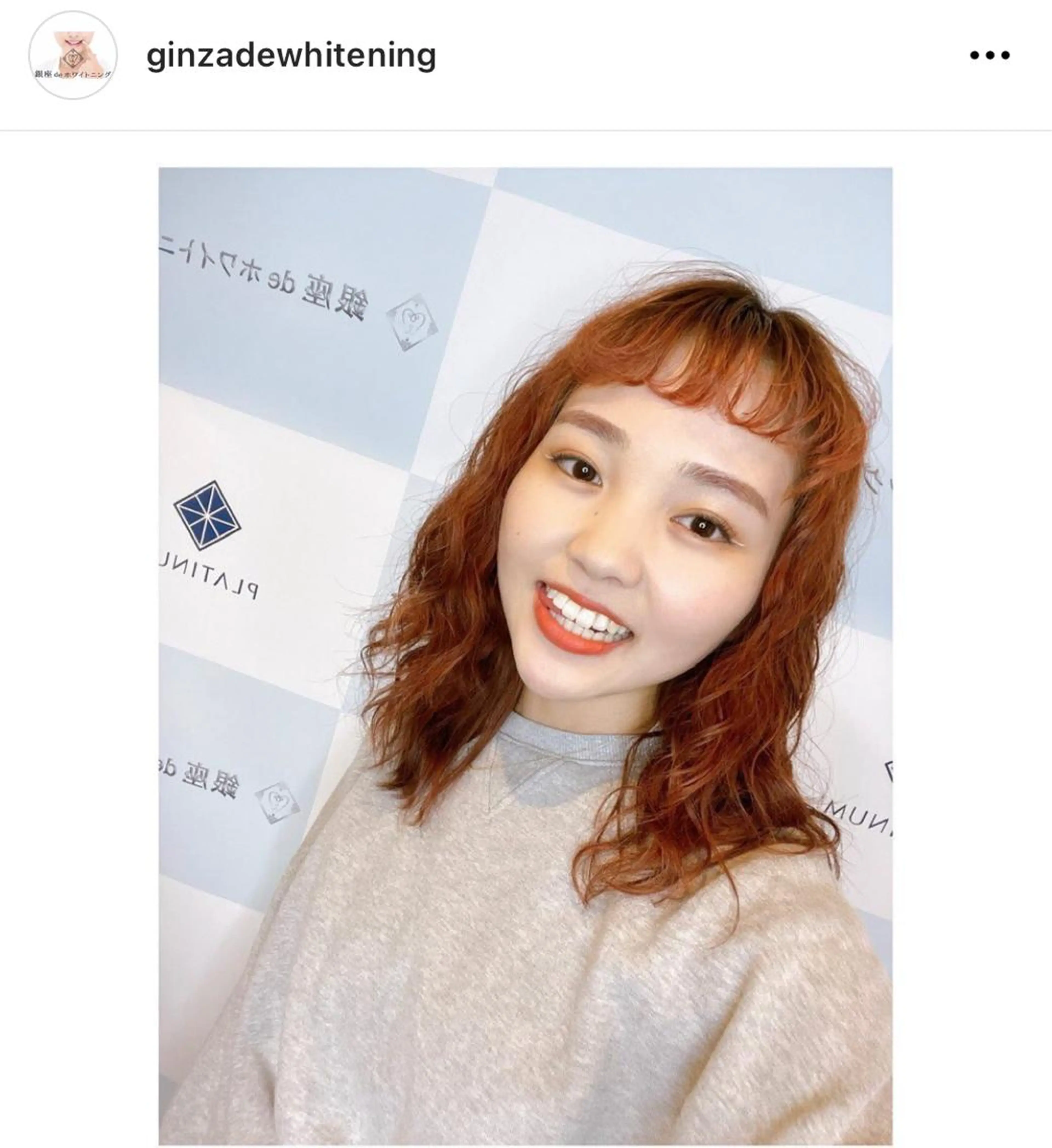 銀座de ホワイトニングのその他イメージ