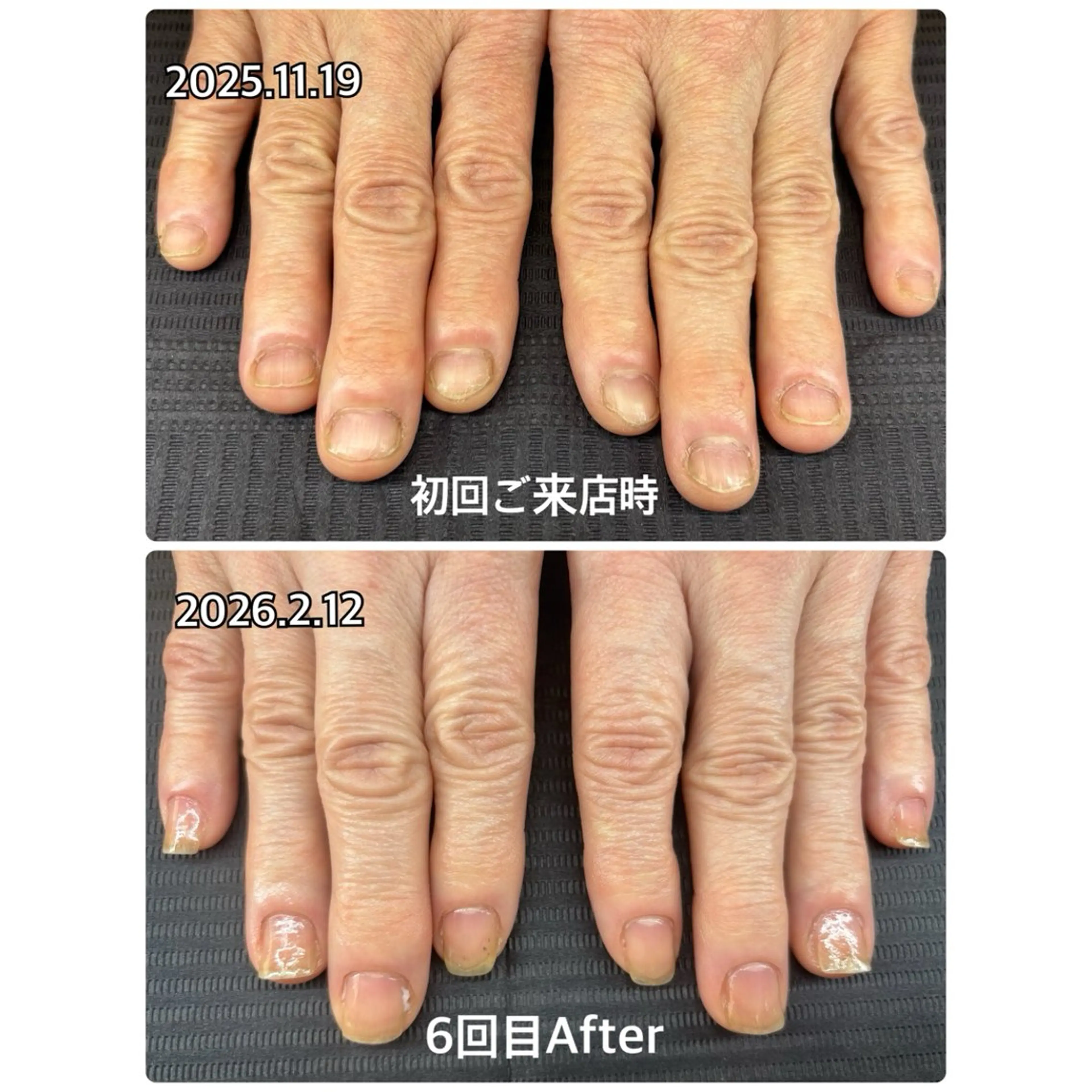 ネイル ハンドケア 高木 みどりのネイルデザイン