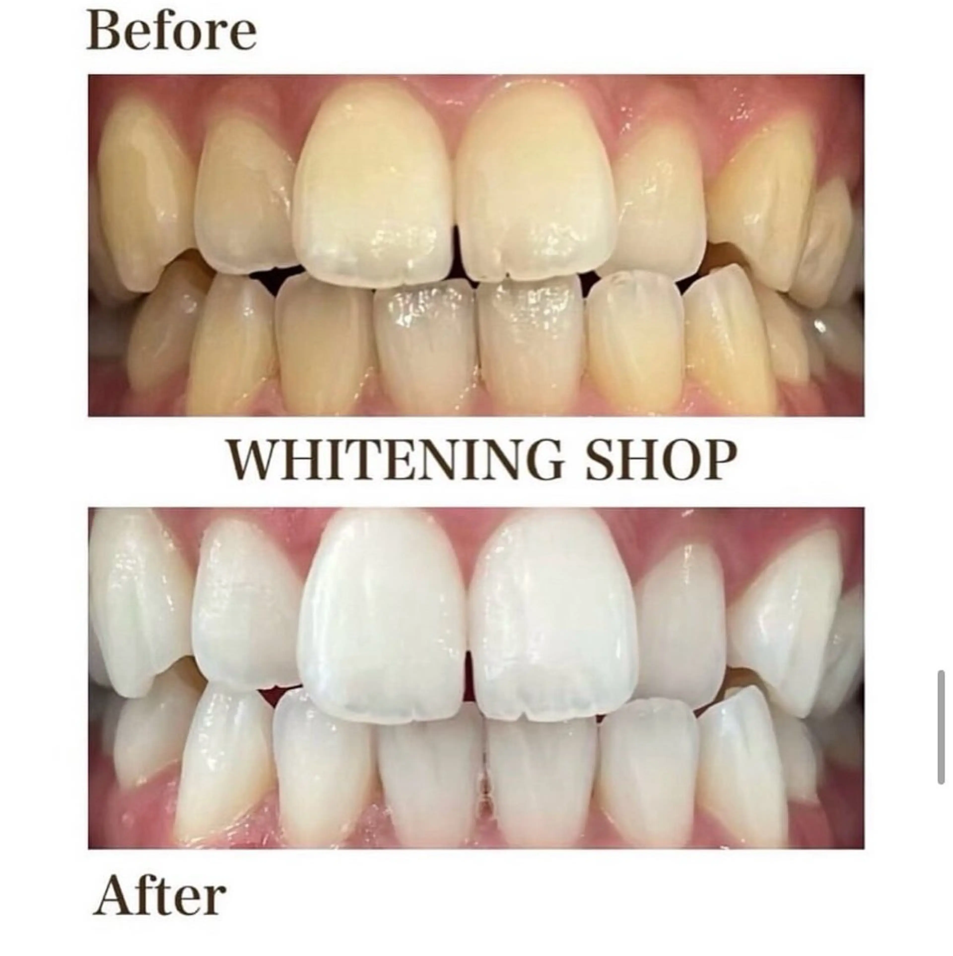 その他 ホワイトニング ショップ伊丹店のその他イメージ