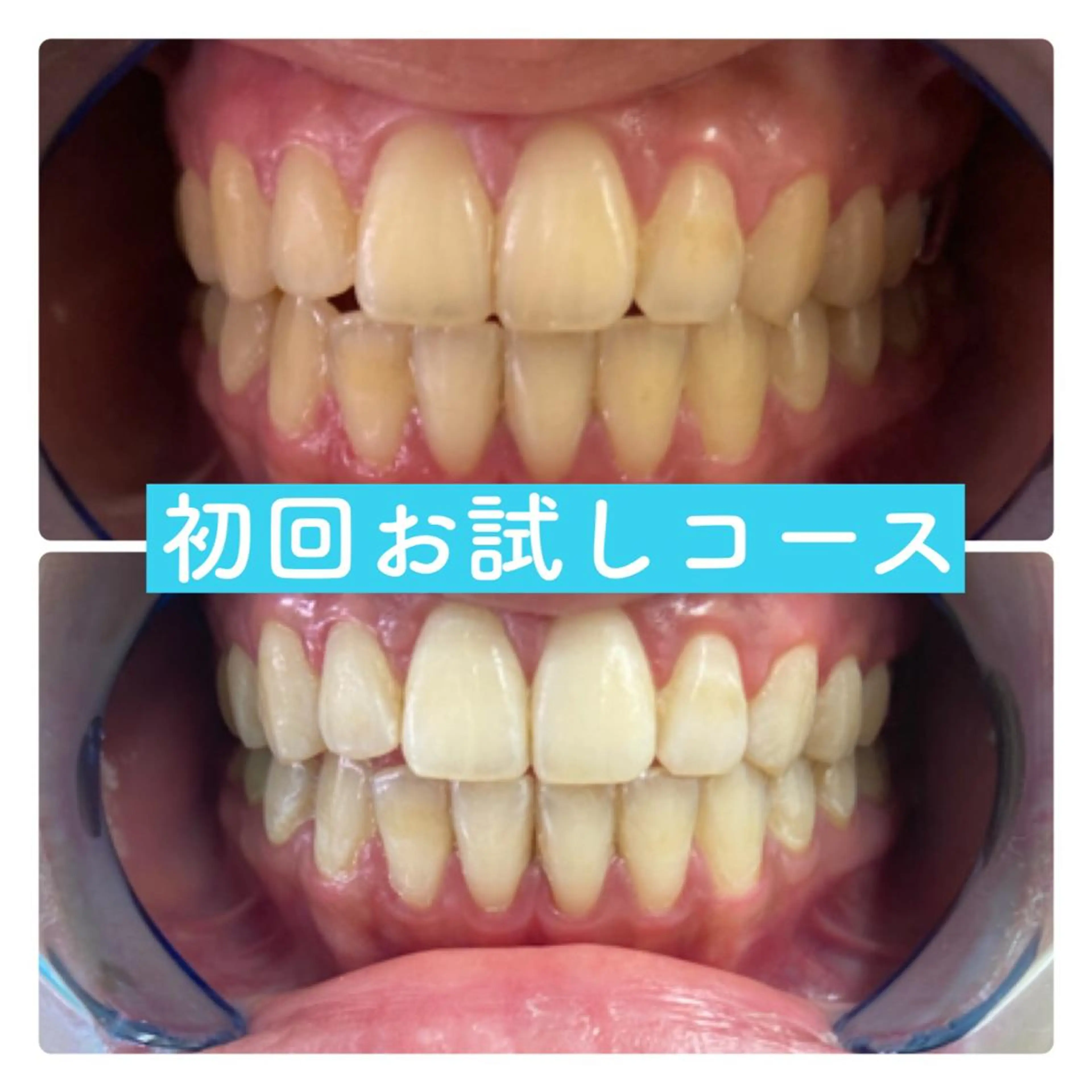 ホワイトニングルーム 横浜店のその他イメージ