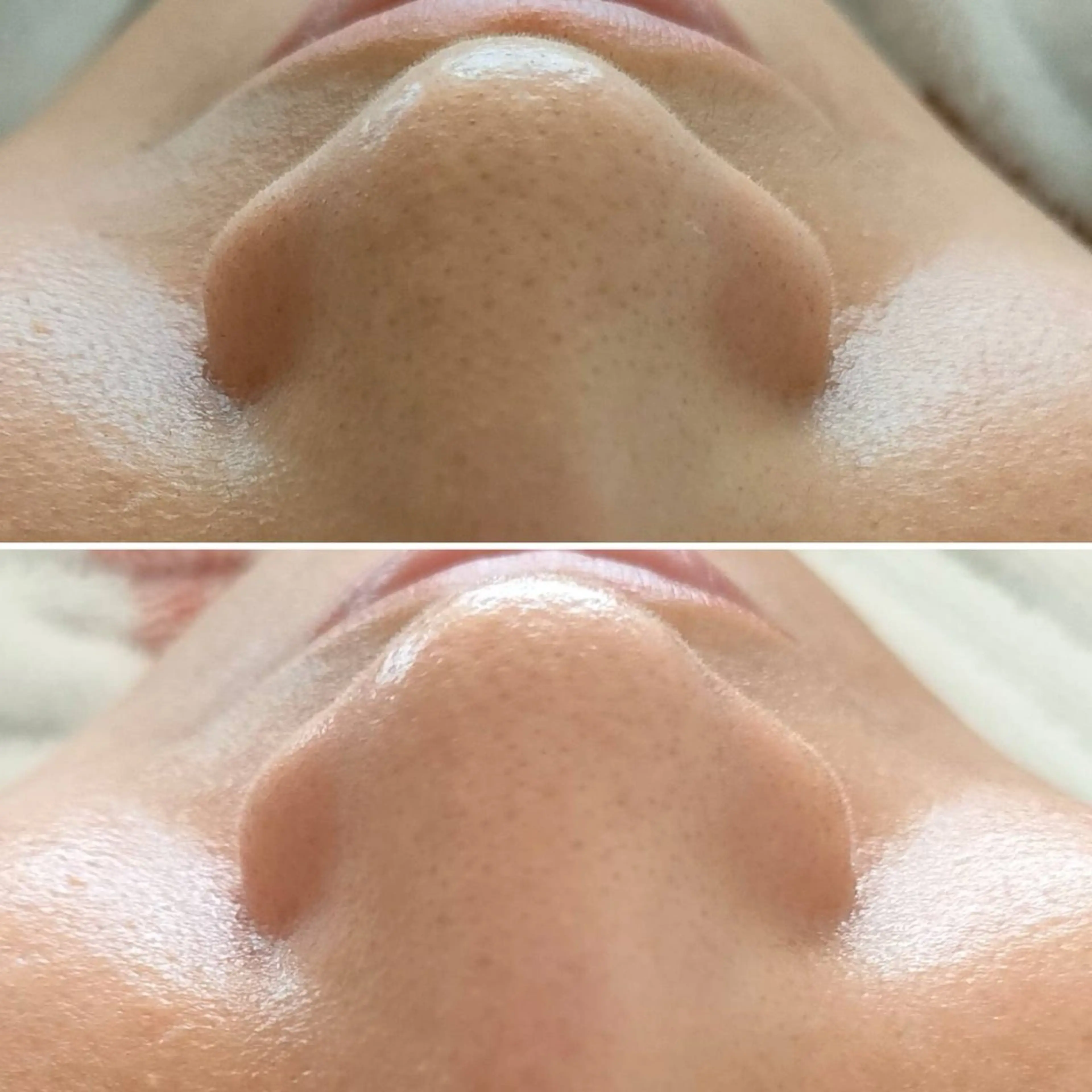 メンズ エステ 美 Faceのエステ・リラクイメージ