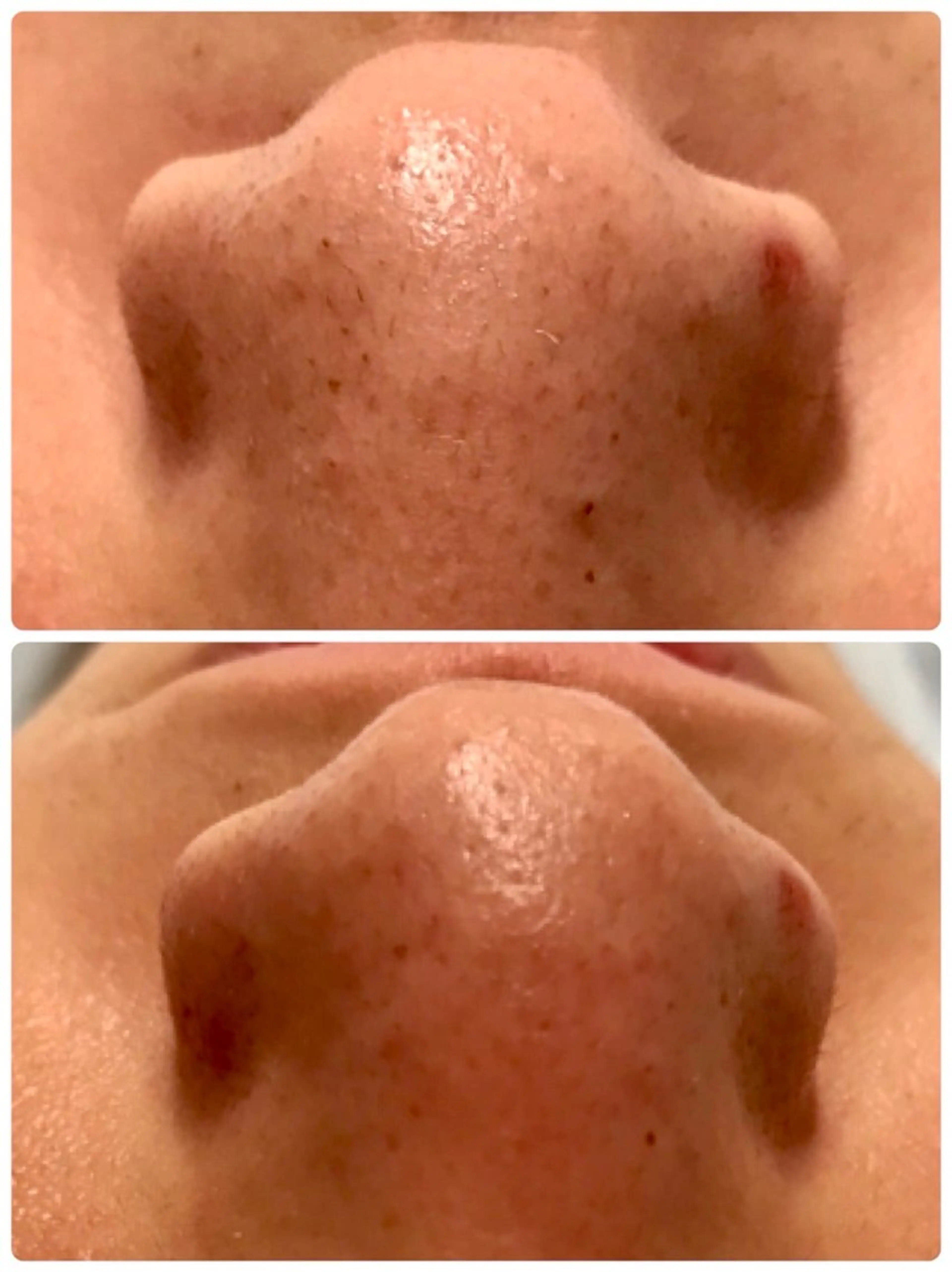 エステ リラク 肌質改善 KALANCHOEのエステ・リラクイメージ