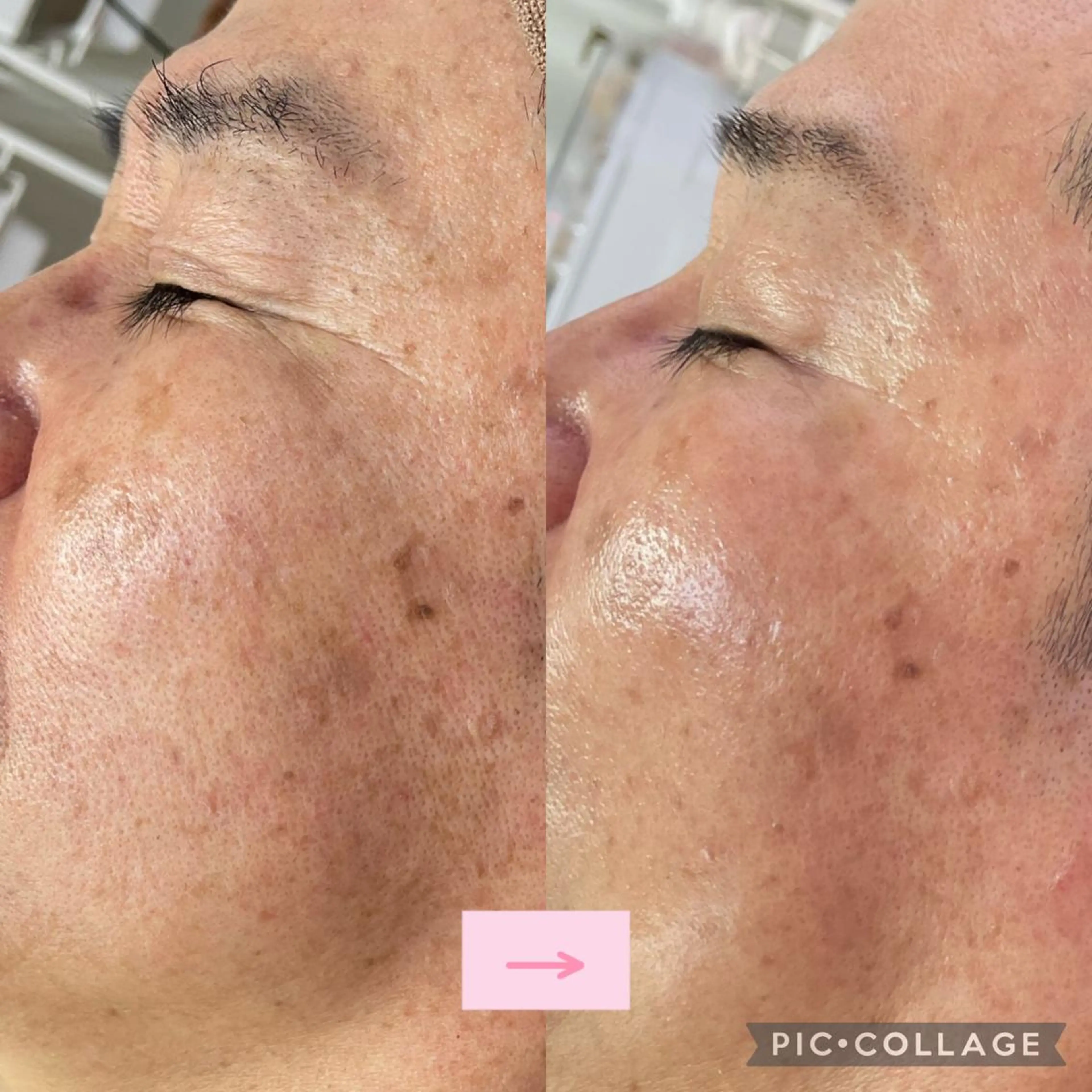 エステサロン LilyRoseのエステ・リラクイメージ