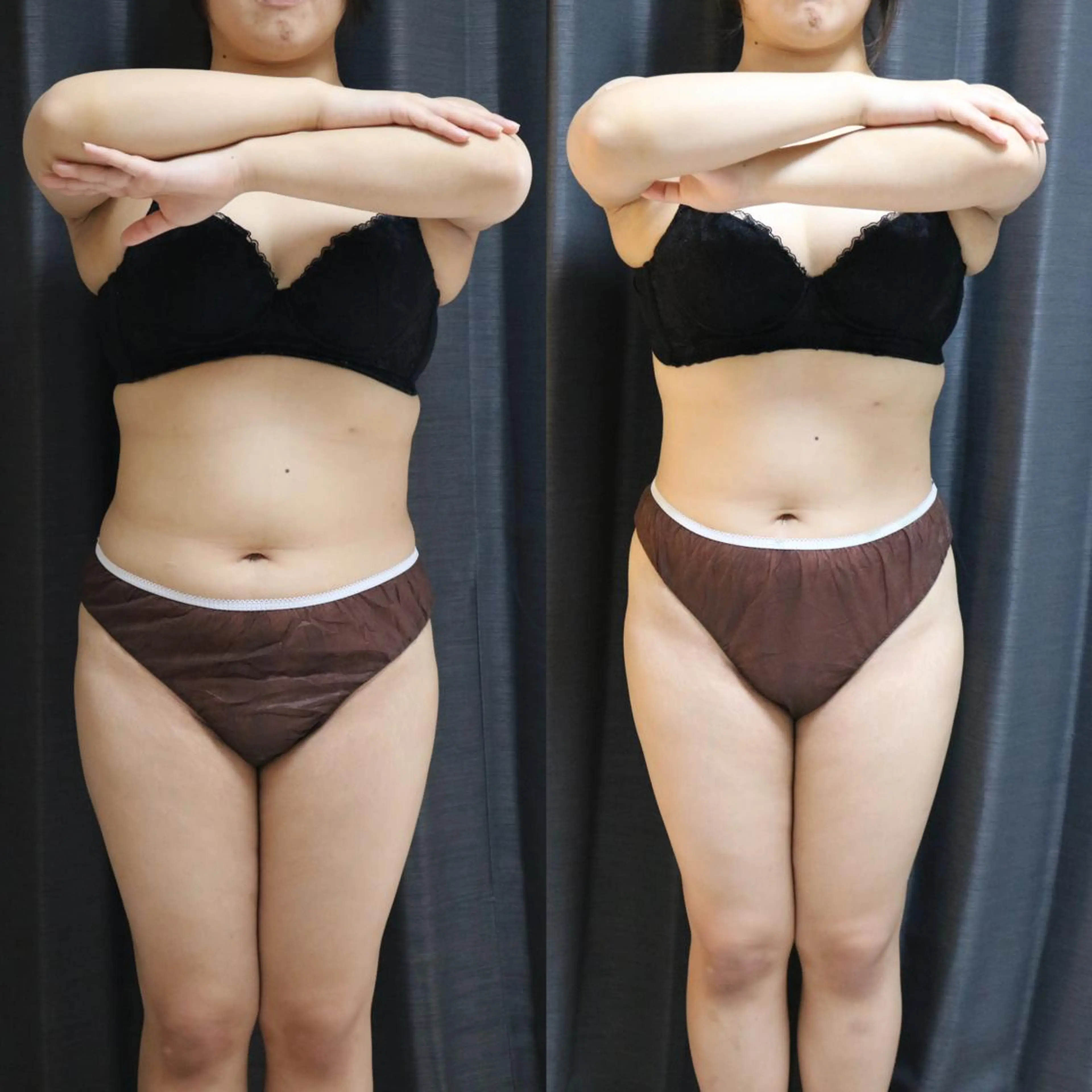 エステ リラク 整♡深層リンパ ronronのその他イメージ