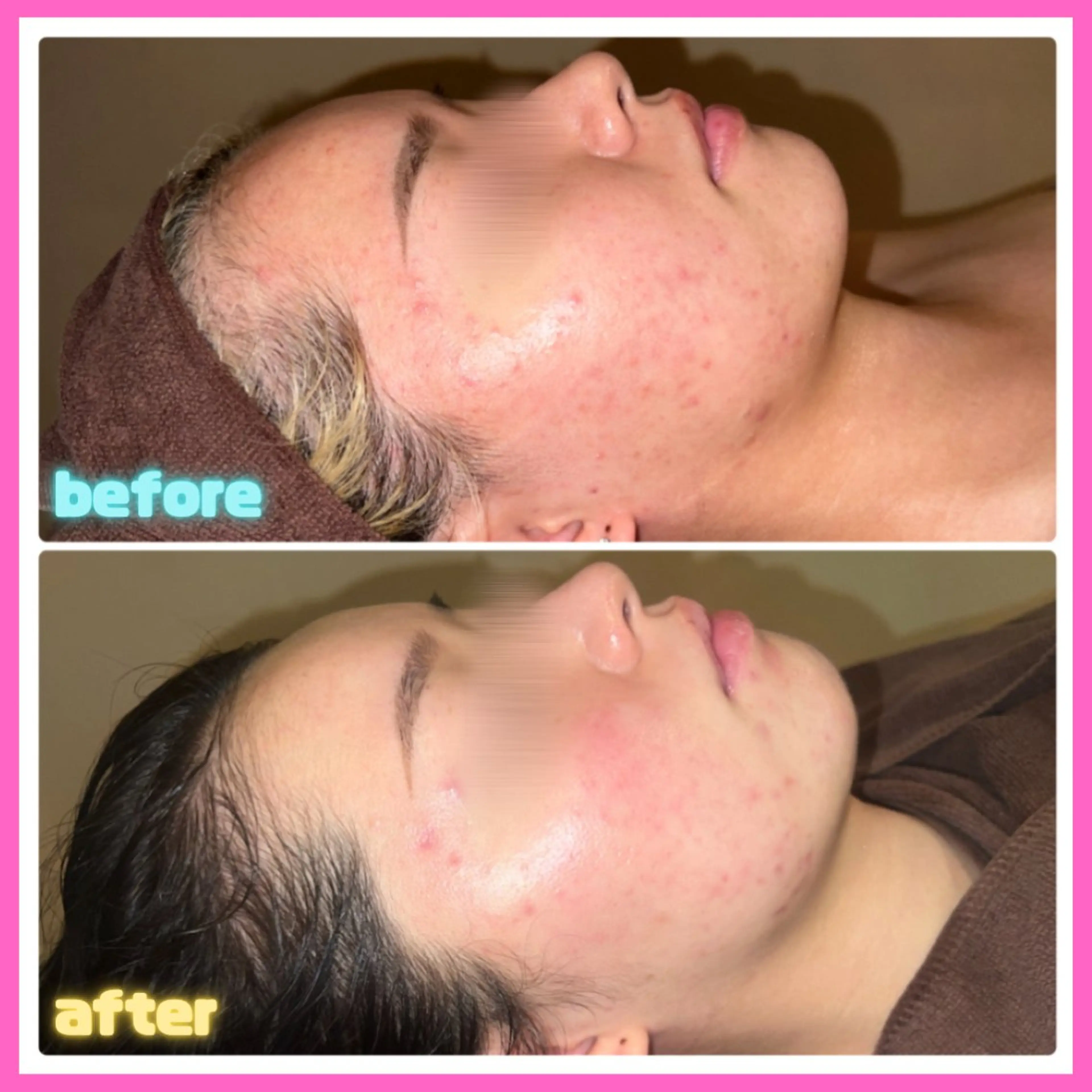 エステ リラク 痩身&美肌サロン 堀米✨のその他イメージ