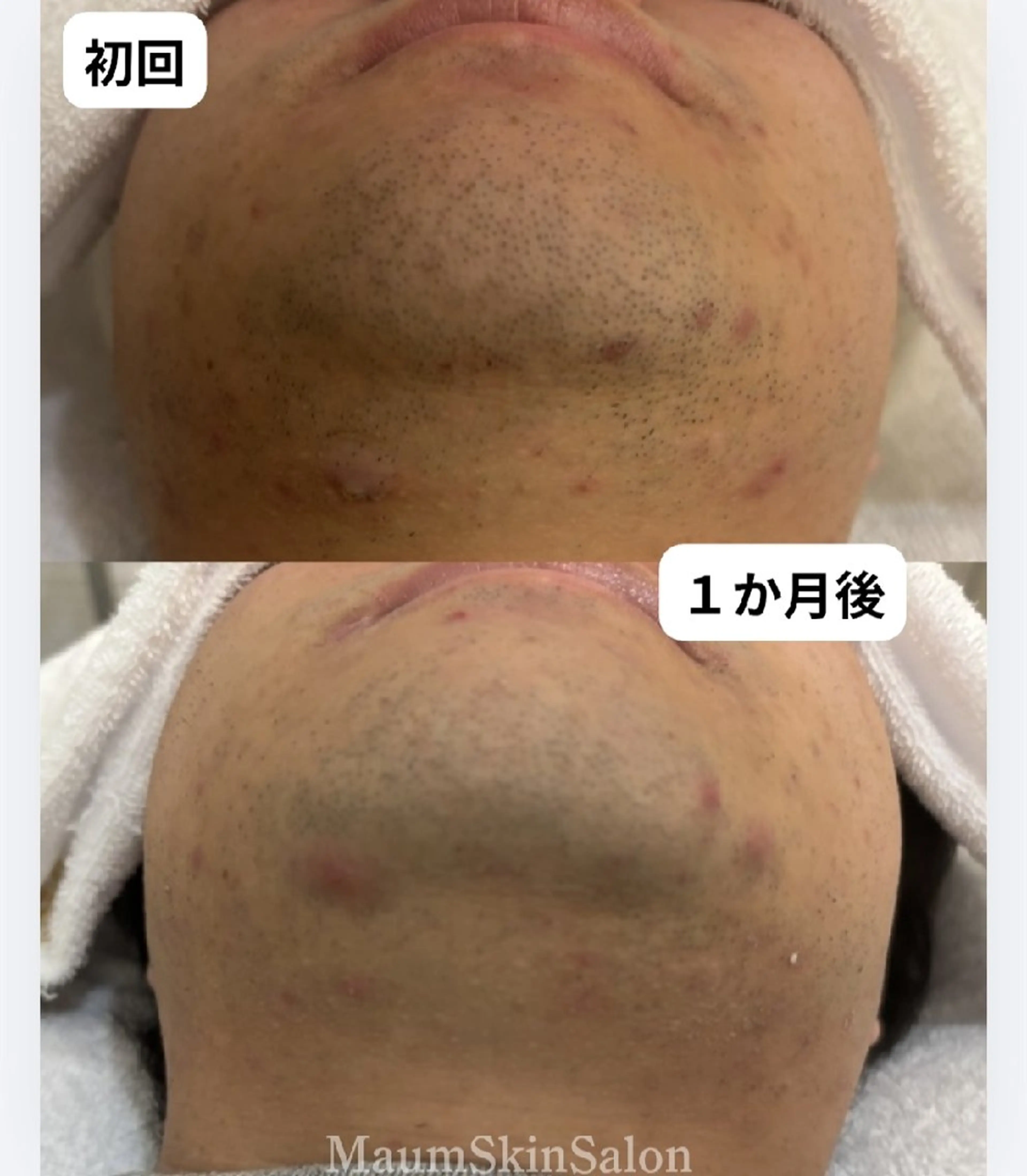 メンズ 脱毛 Maum SkinSalonのエステ・リラクイメージ