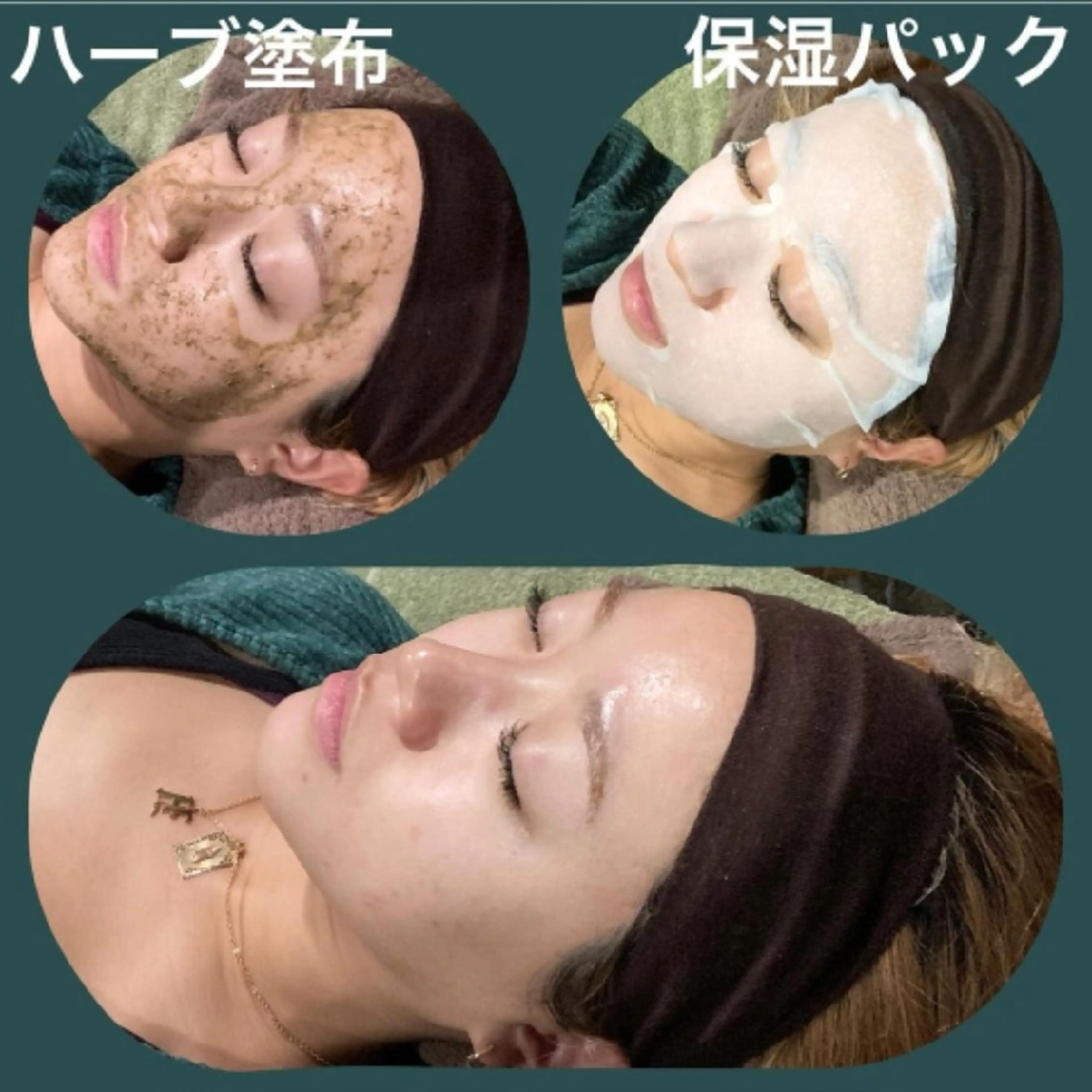 エステ AHOKA所属・米田 亜沙美のエステ・リラクイメージ