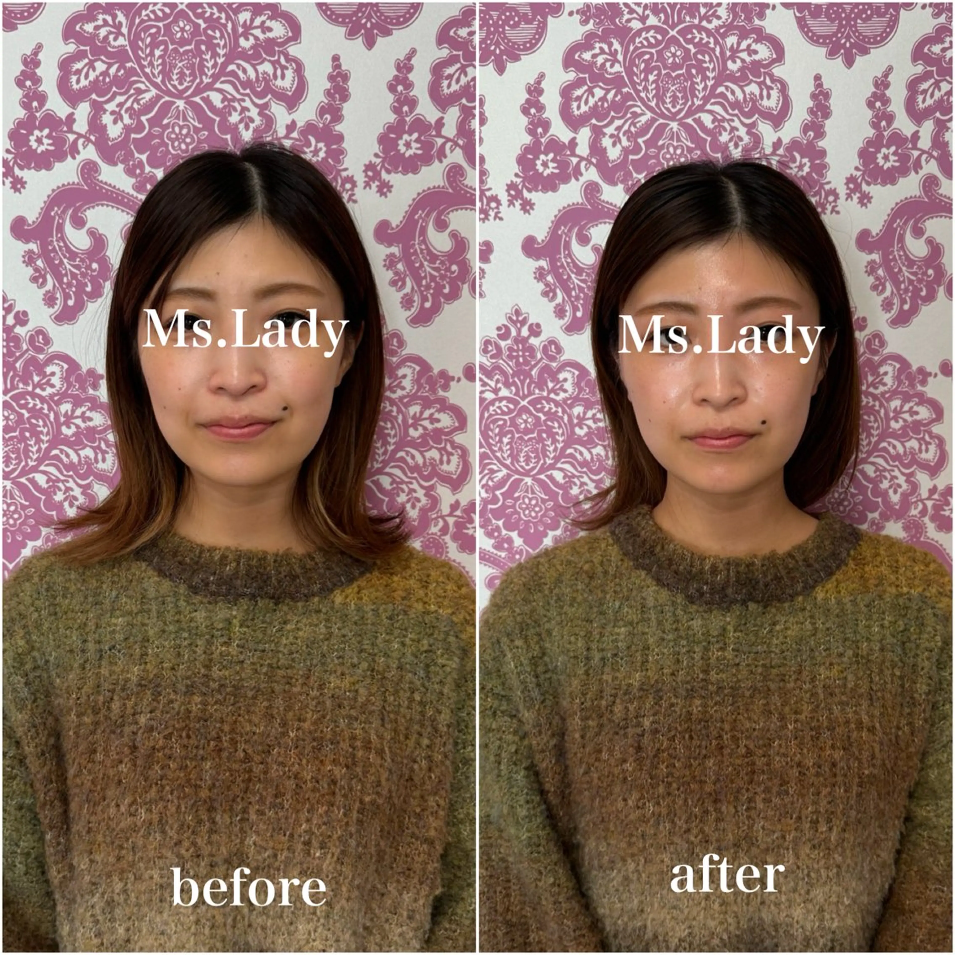 エステ 毛穴レス ハーブ＆ ワックス脱毛×光脱毛のエステ・リラクイメージ