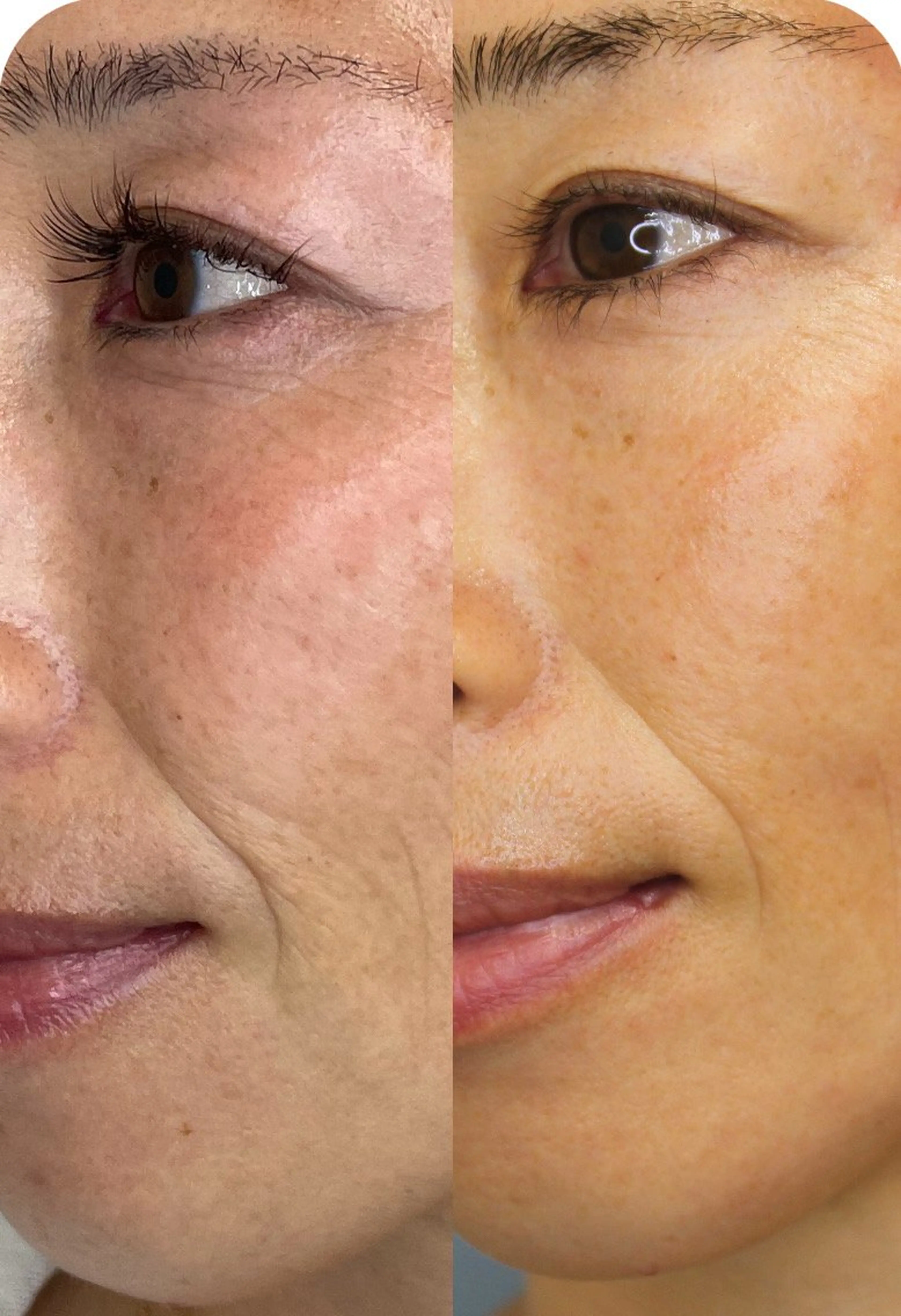 エステ moe所属・moe beautyのマツエク・マツパデザイン