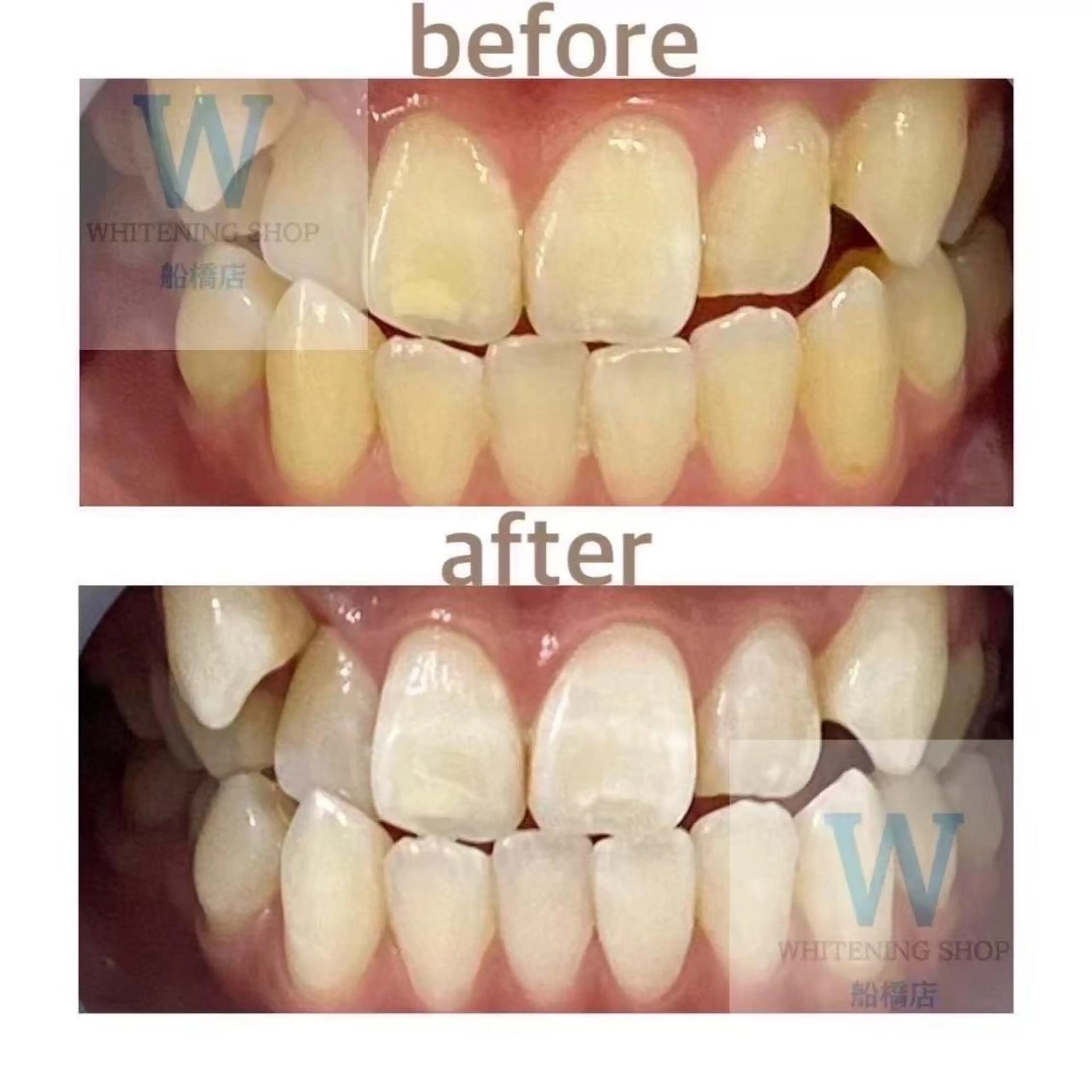 ホワイトニング ショップ船橋店🦷のエステ・リラクイメージ