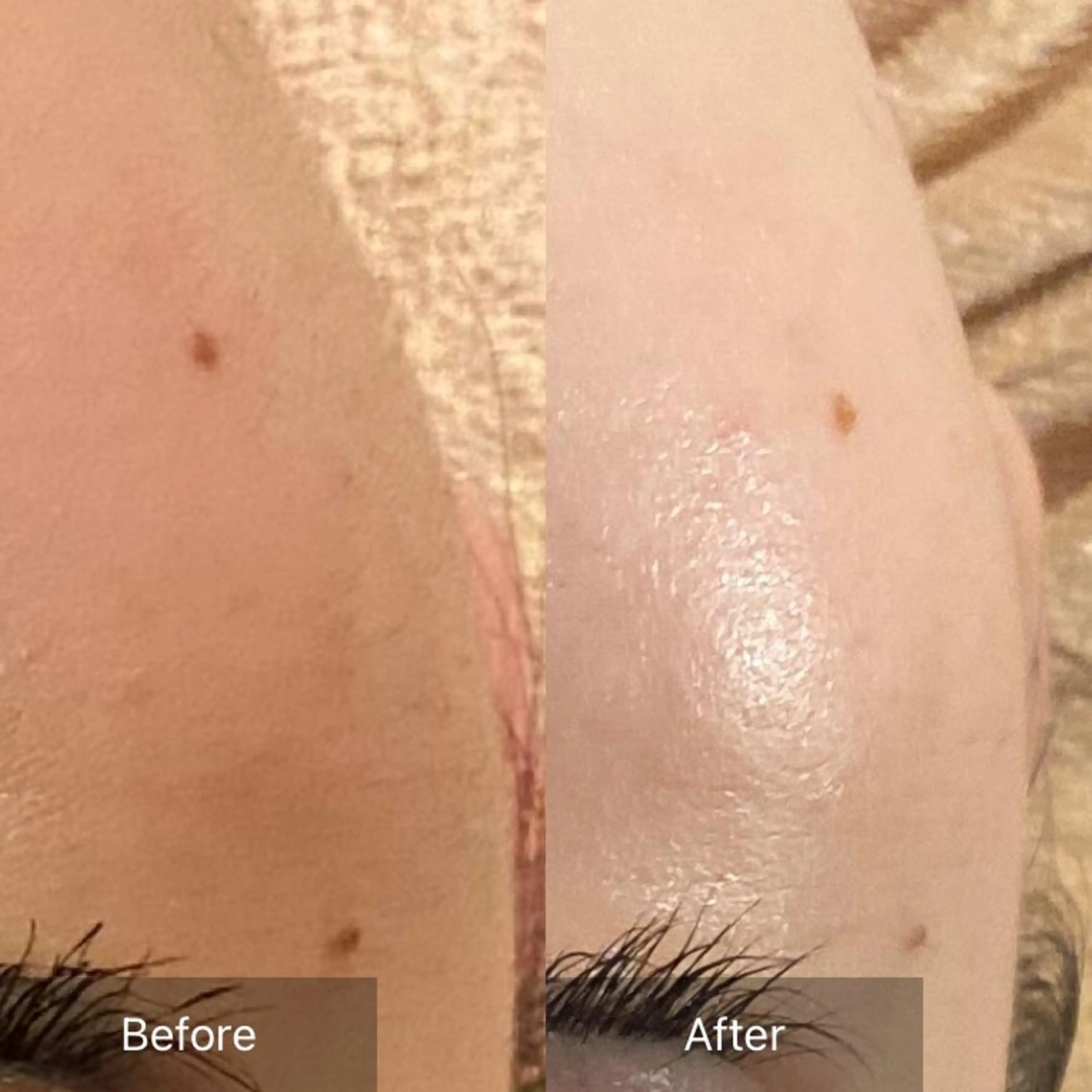 Mandarin Orange所属・毛穴から始める肌メン テマンダリンオレンジのエステ・リラクイメージ