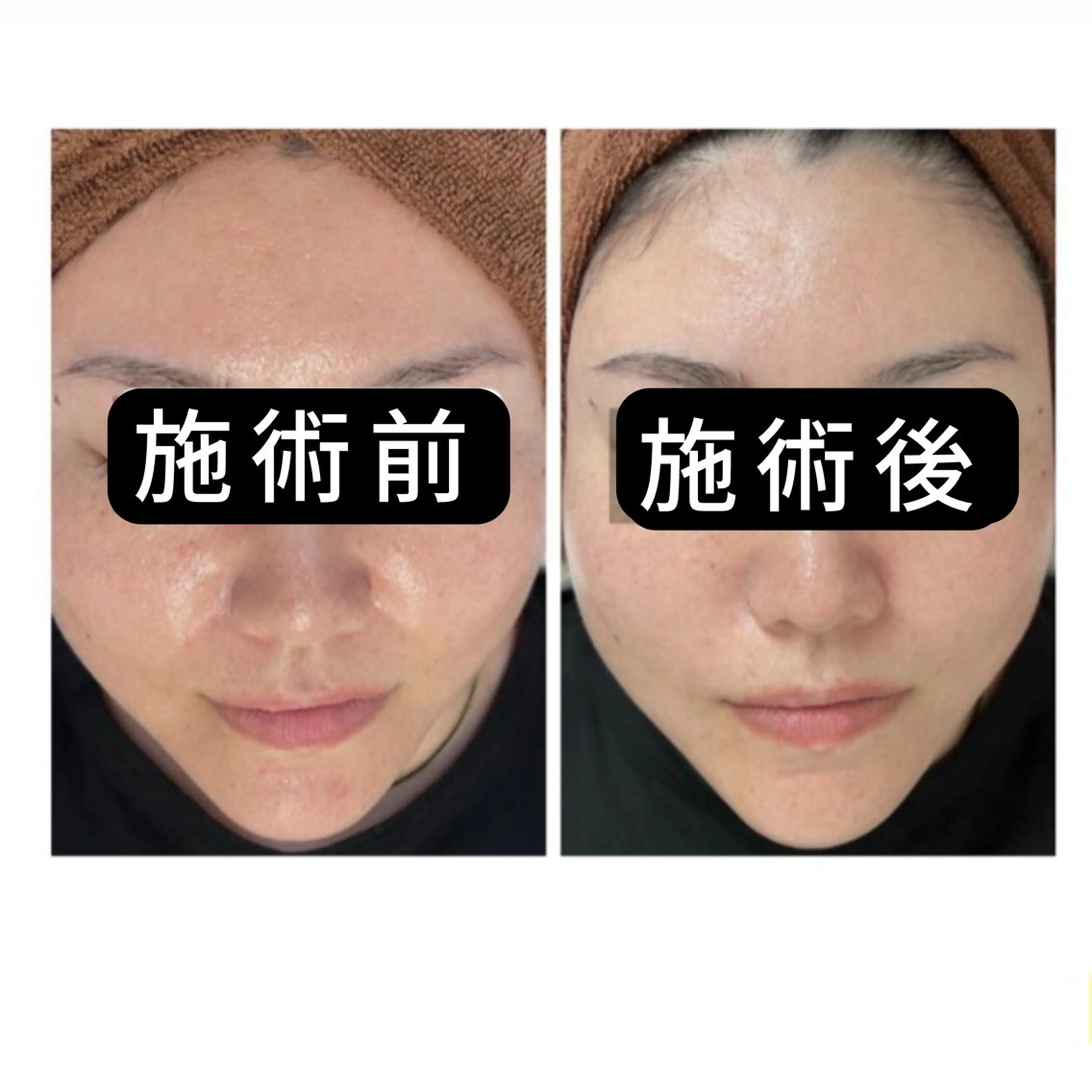 エステ リラク 渋谷 小顔美容鍼 専門サロン YZのエステ・リラクイメージ