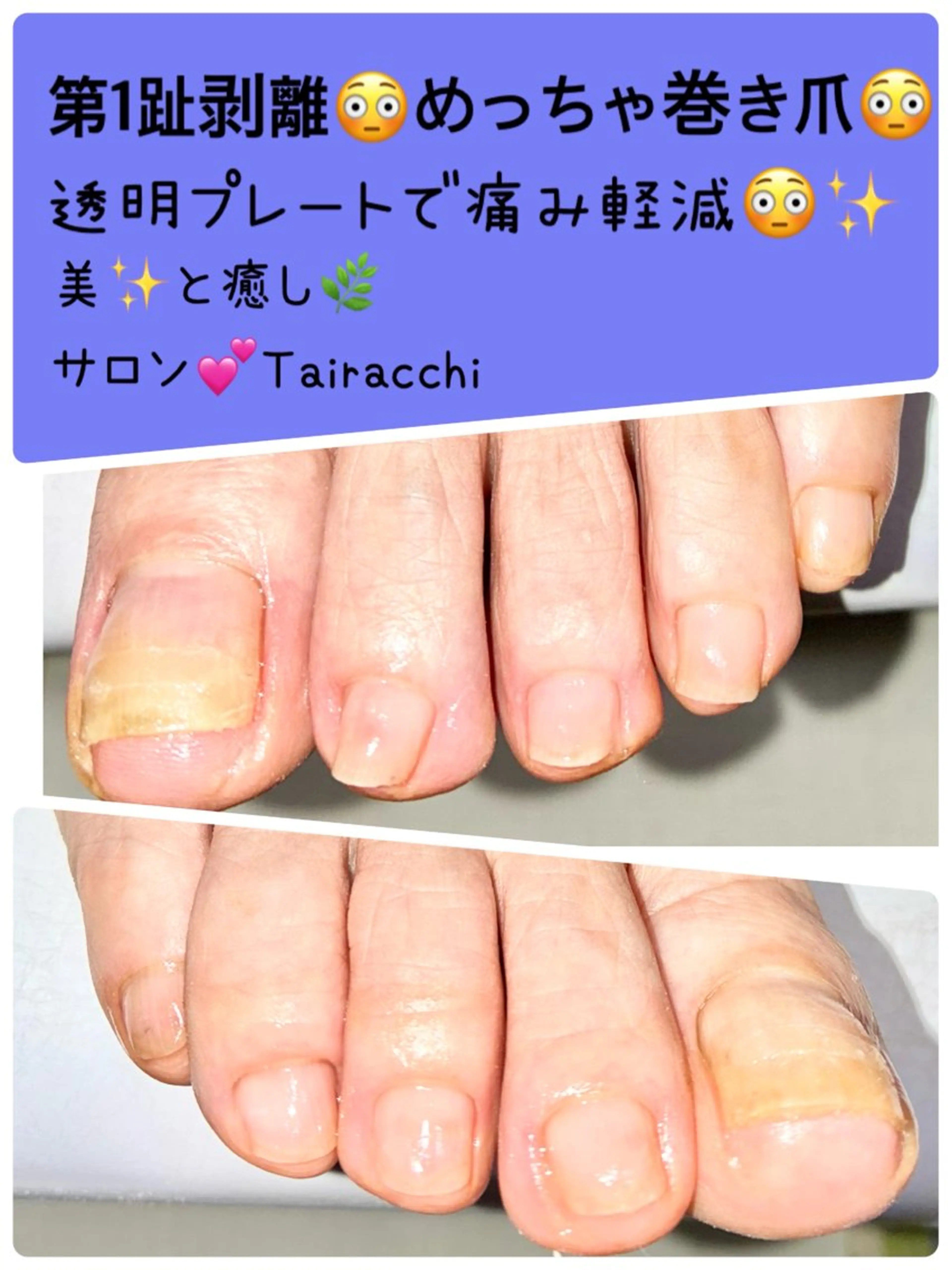 ネイル フットネイル Tairacchi タイラッチのネイルデザイン
