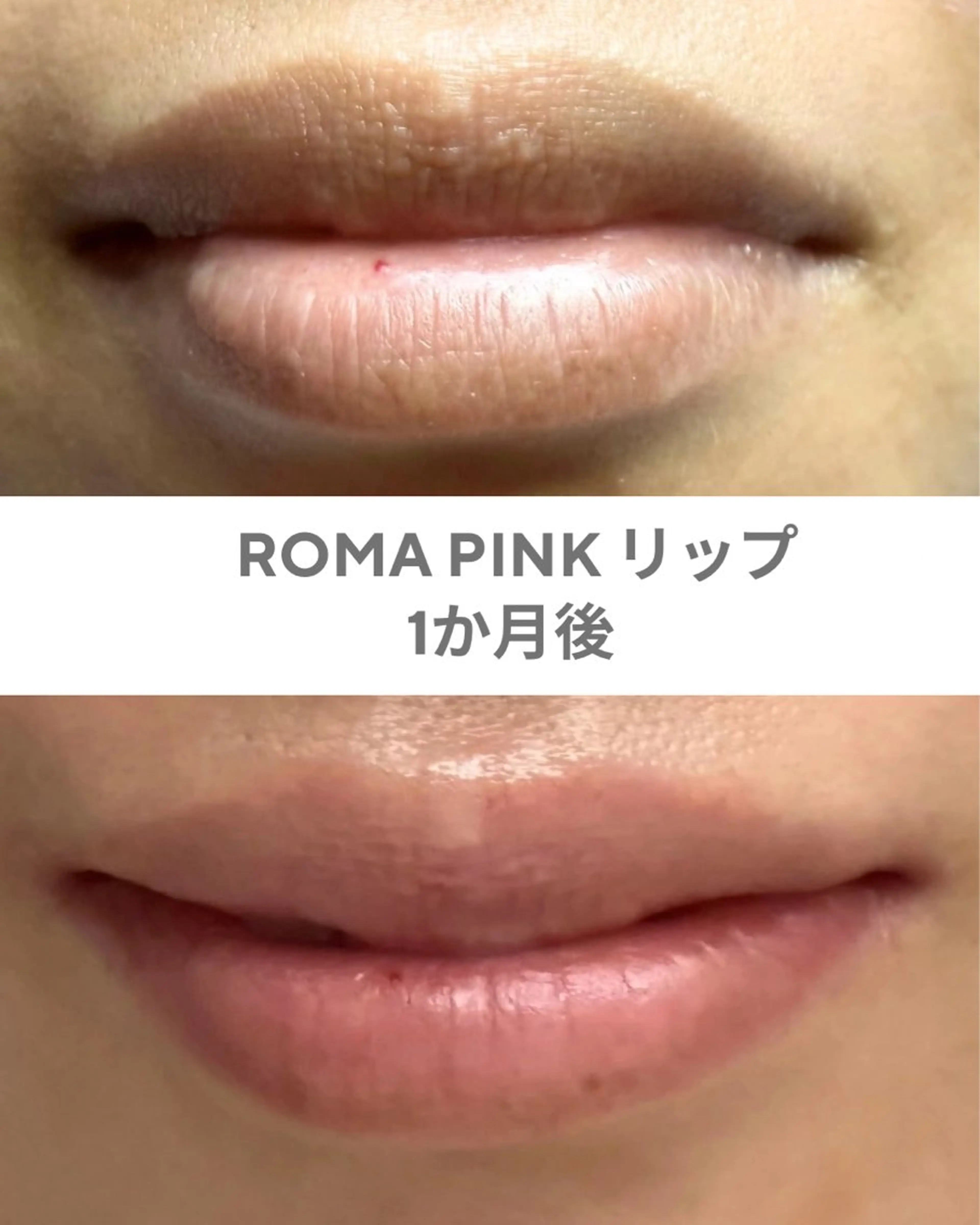 GrandAzure 大人の肌改善のエステ・リラクイメージ