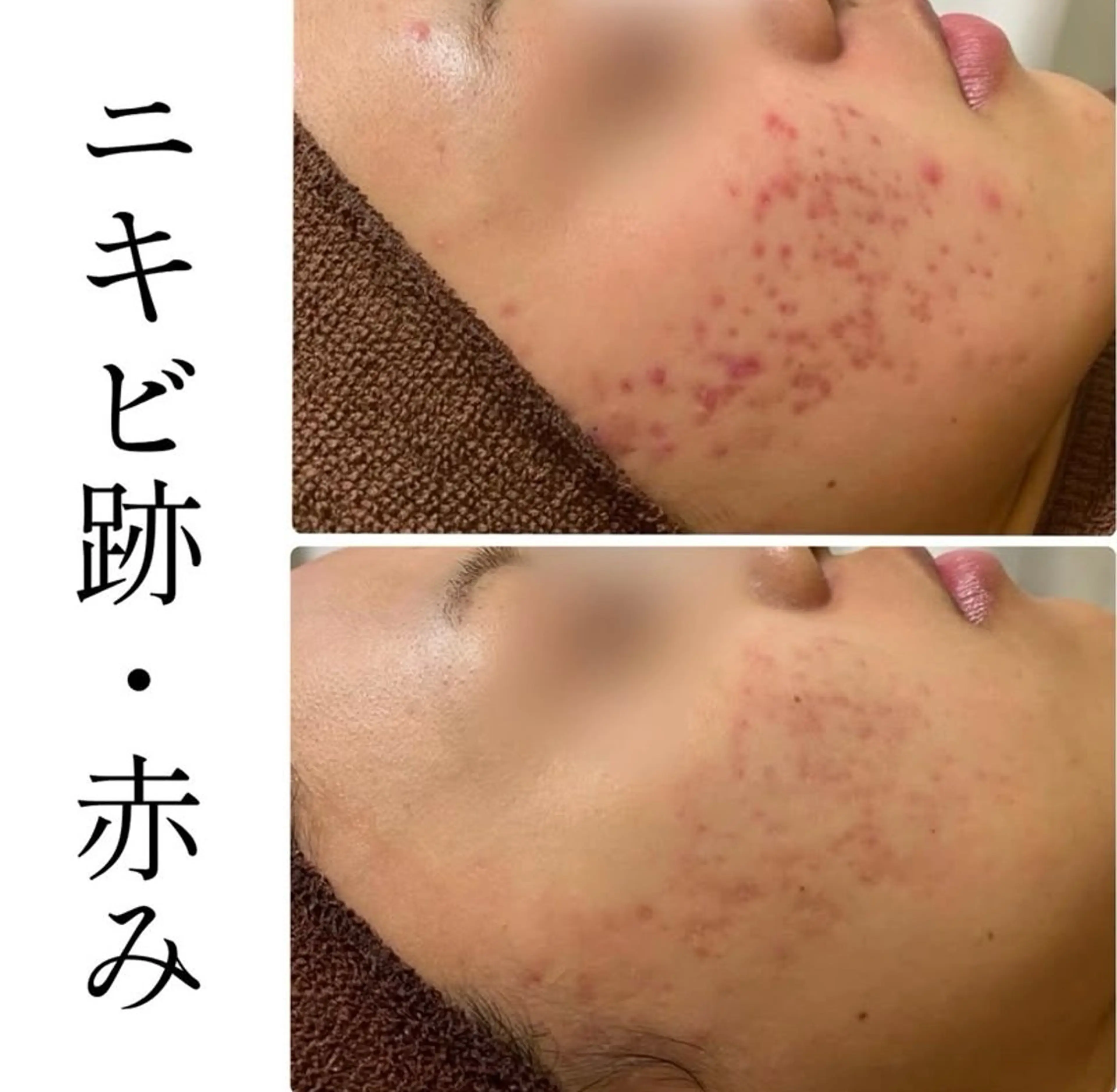 エステ ハーブピーリング専門 BIOPLUS+川崎のエステ・リラクイメージ