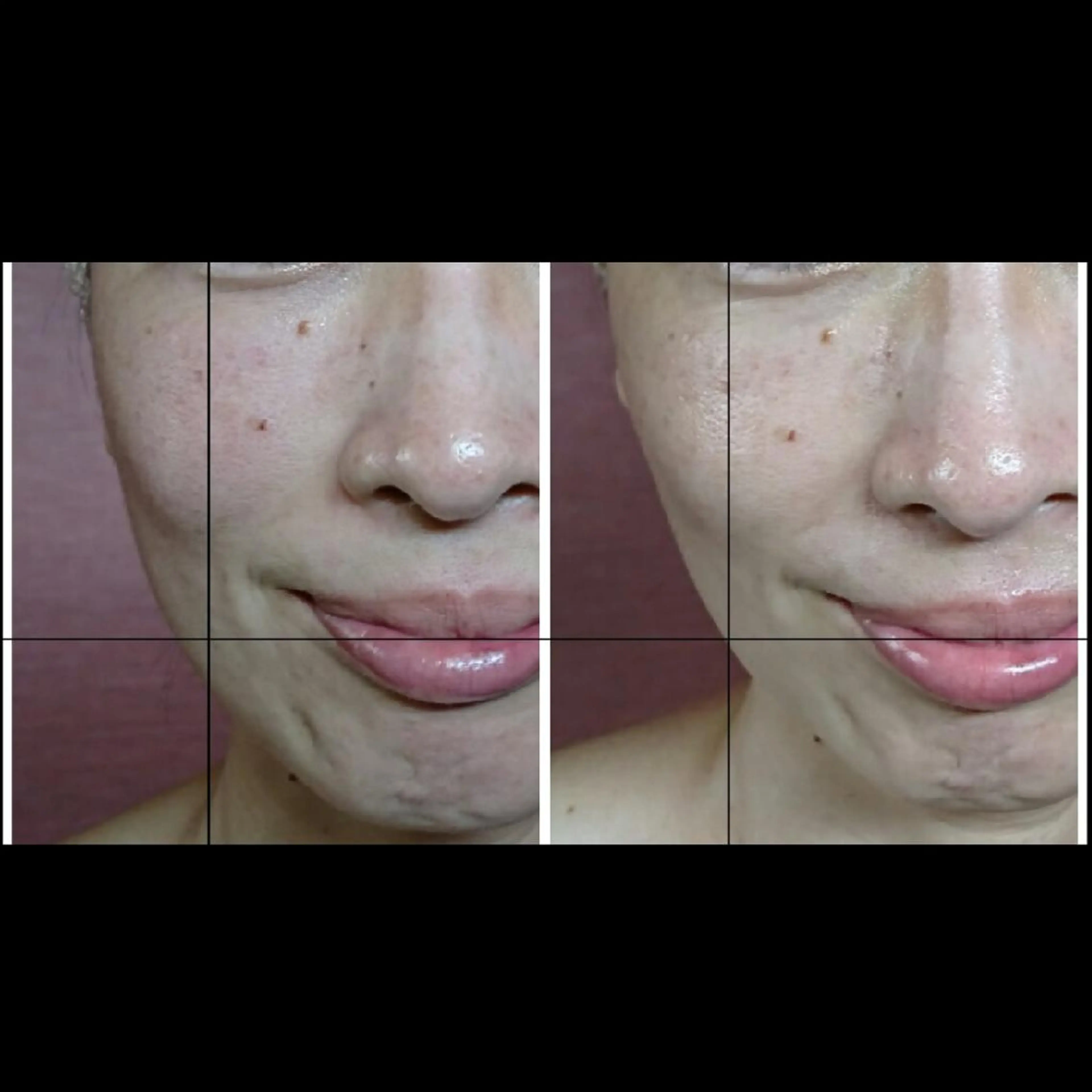 エステ リラク Nako ナコのエステ・リラクイメージ