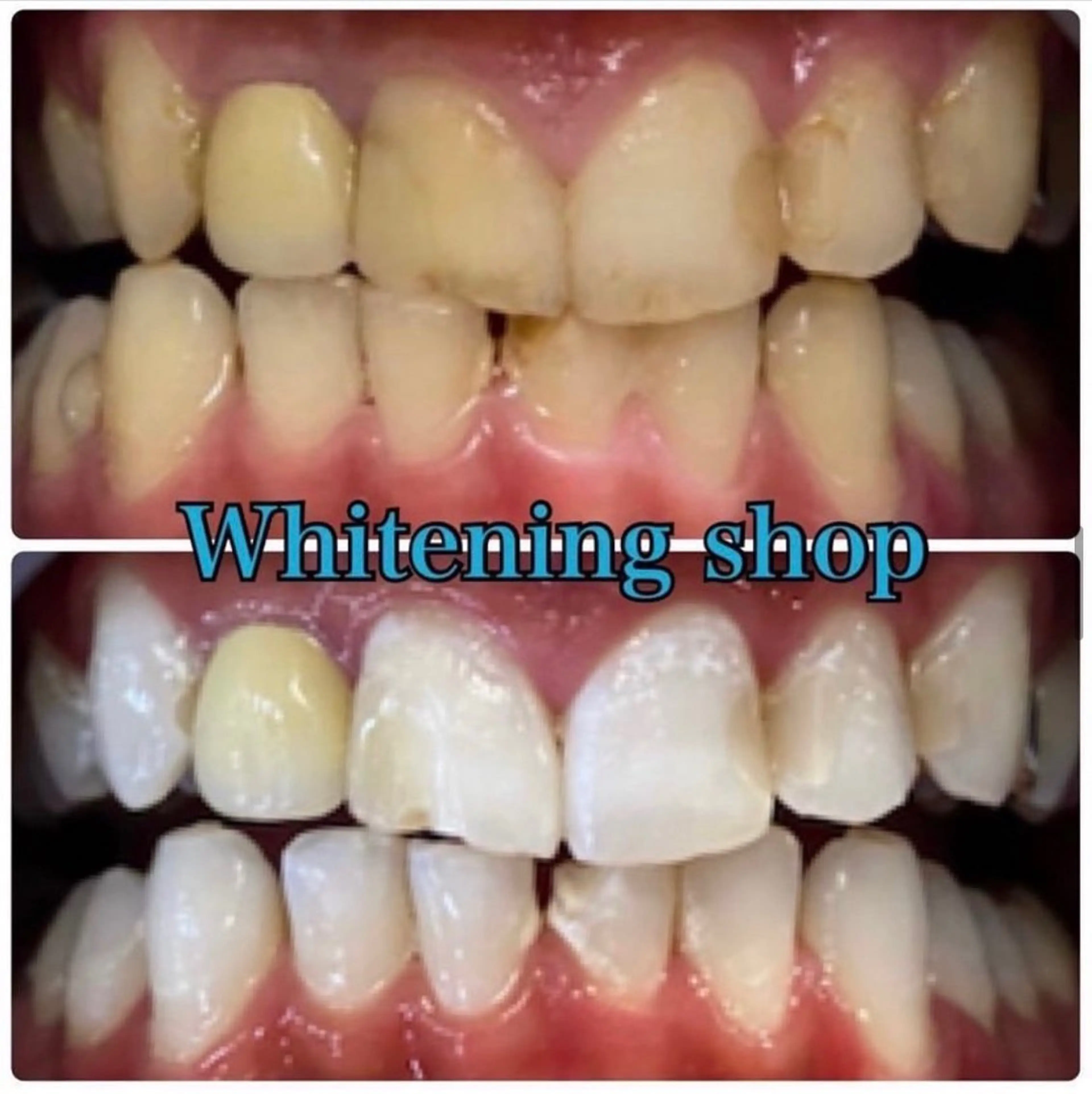 ホワイトニング ショップ吉祥寺店のエステ・リラクイメージ