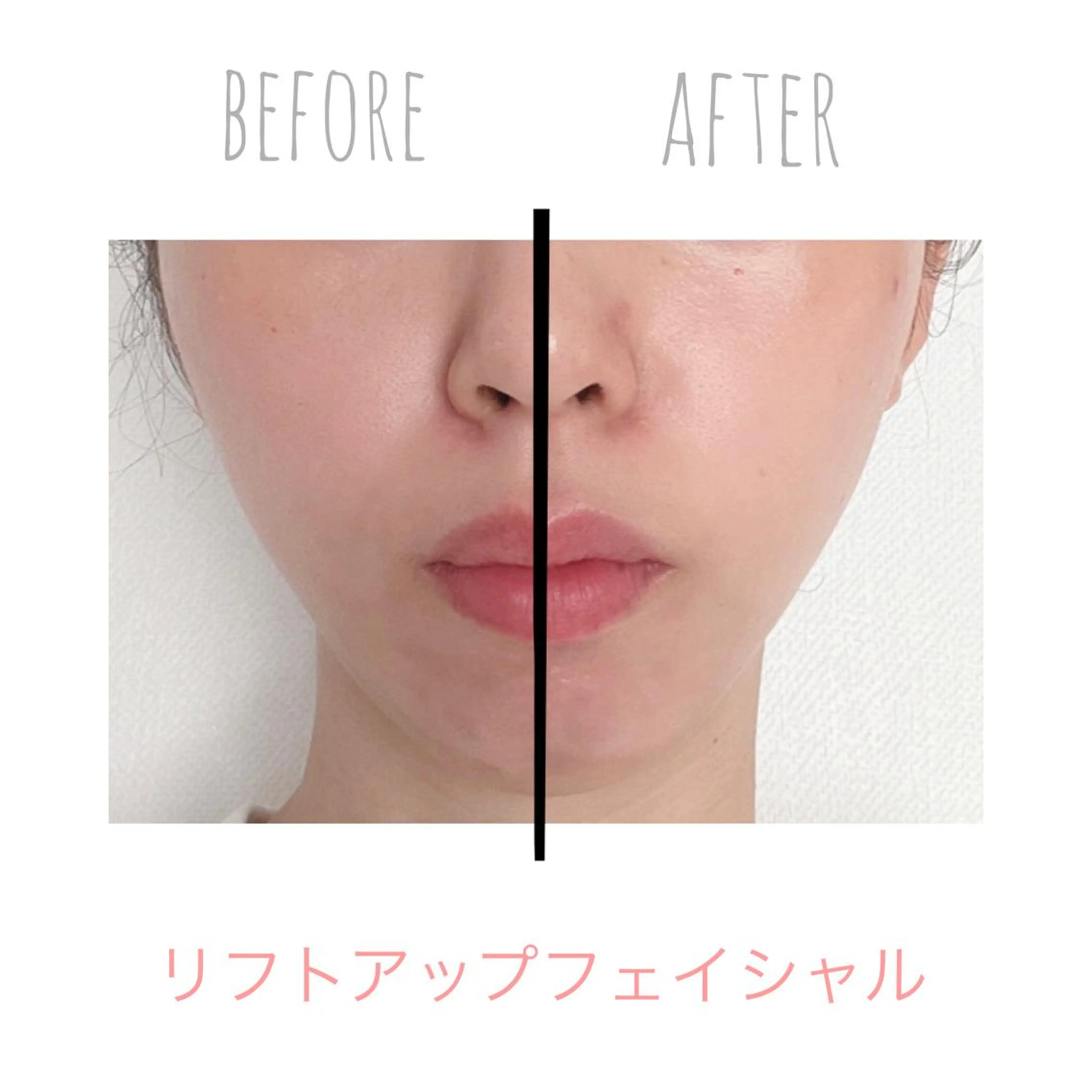 妊活・婦人科お悩み Moonbowのエステ・リラクイメージ