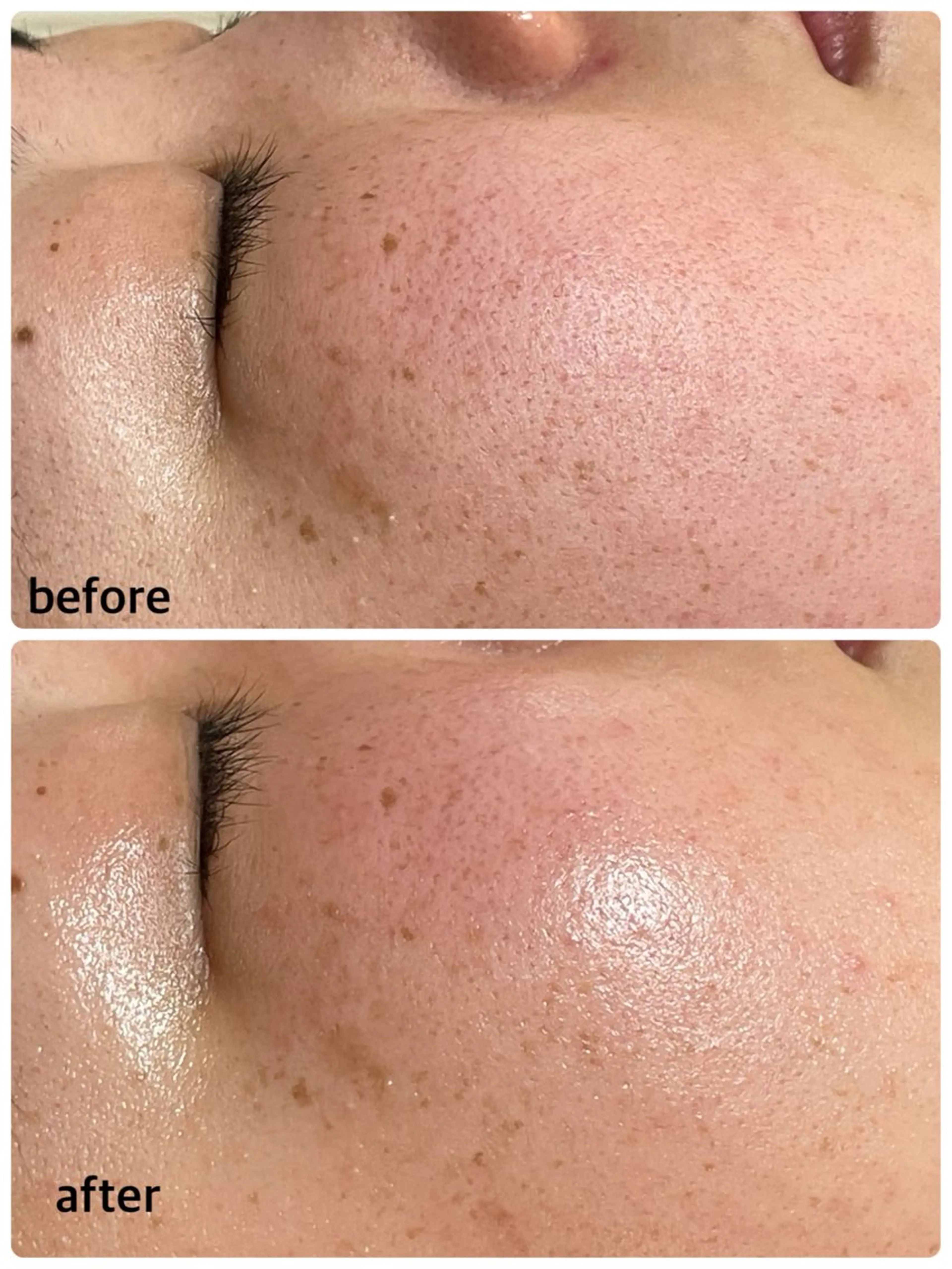 エステ 肌質改善専門店/絹々(きぬ)所属・心満たされる ハーブピーリング絹々のエステ・リラクイメージ