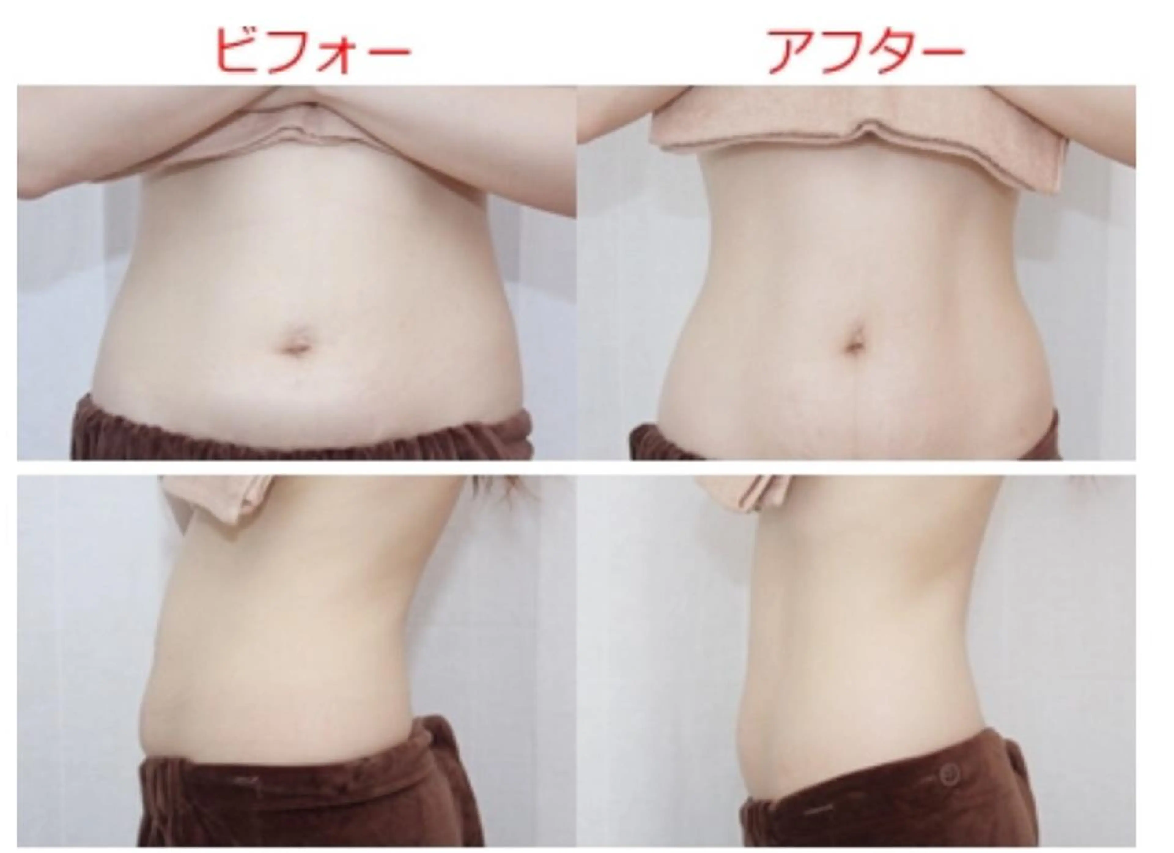 【ご新規様限定】✨全身デトックス✨ハイパーナイフ&オールハンドリンパドレナージュ！ハイパーナイフスリム！贅沢に160分！の写真