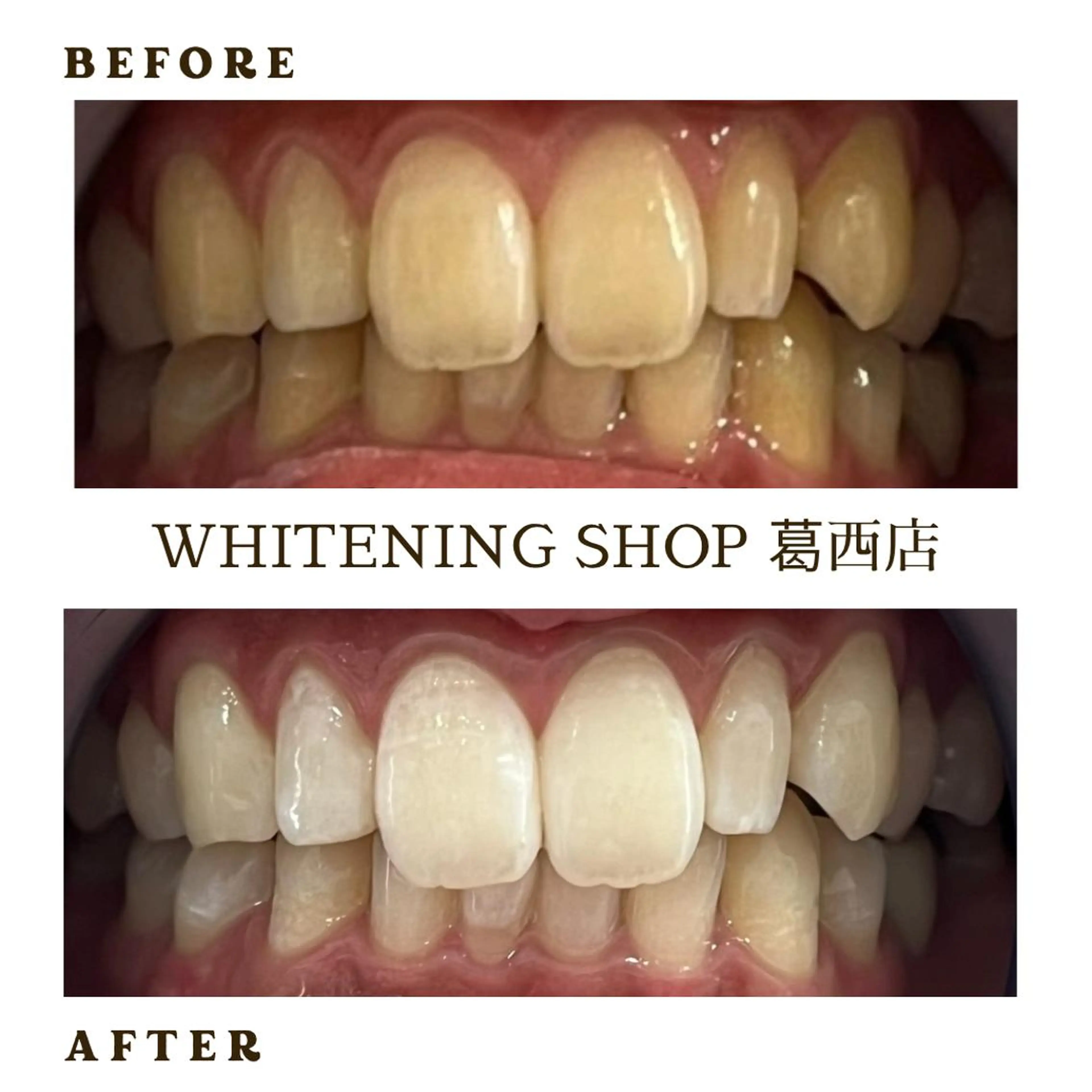 メンズ その他 ホワイトニング ショップ葛西店のその他イメージ