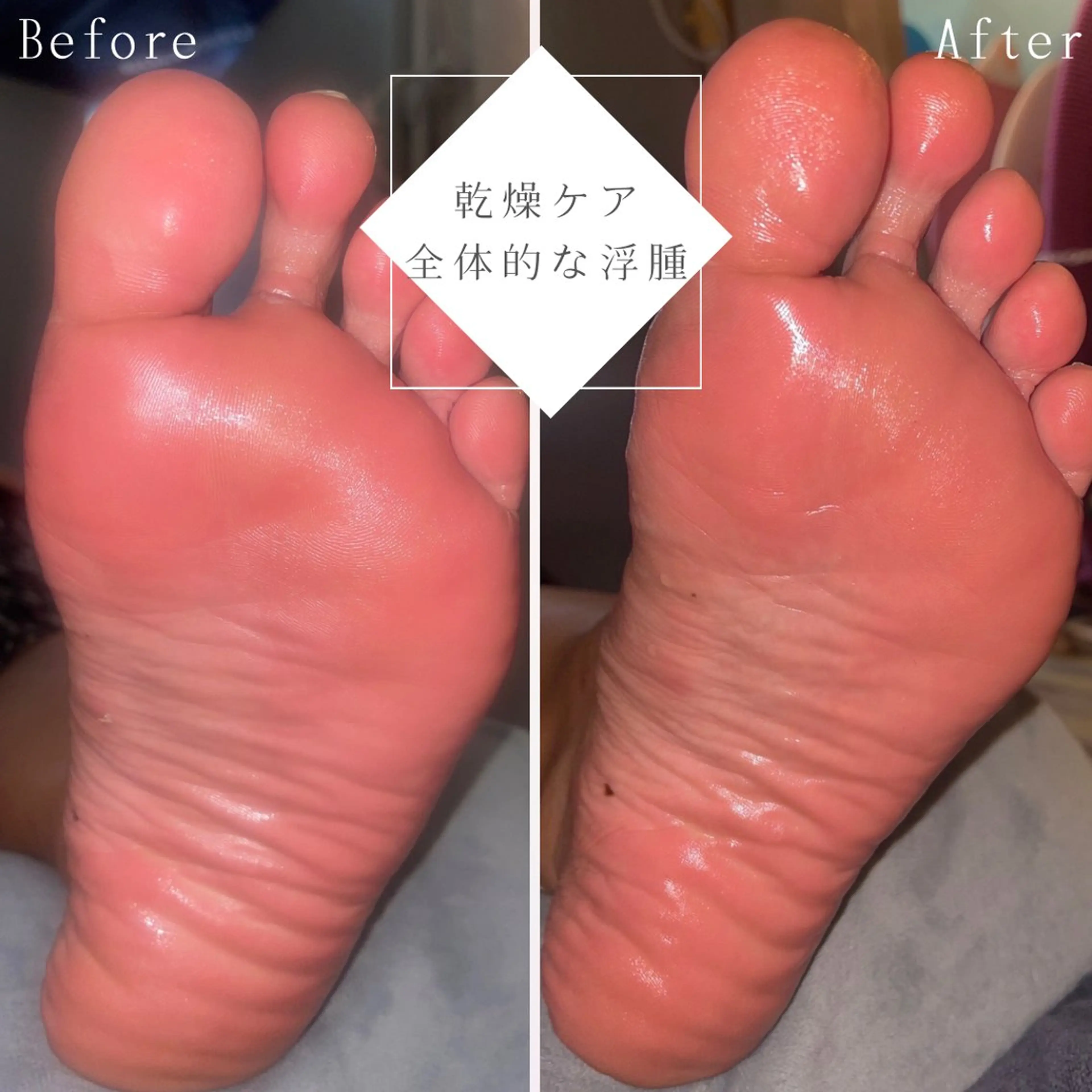 SHARES MADOKAのエステ・リラクイメージ